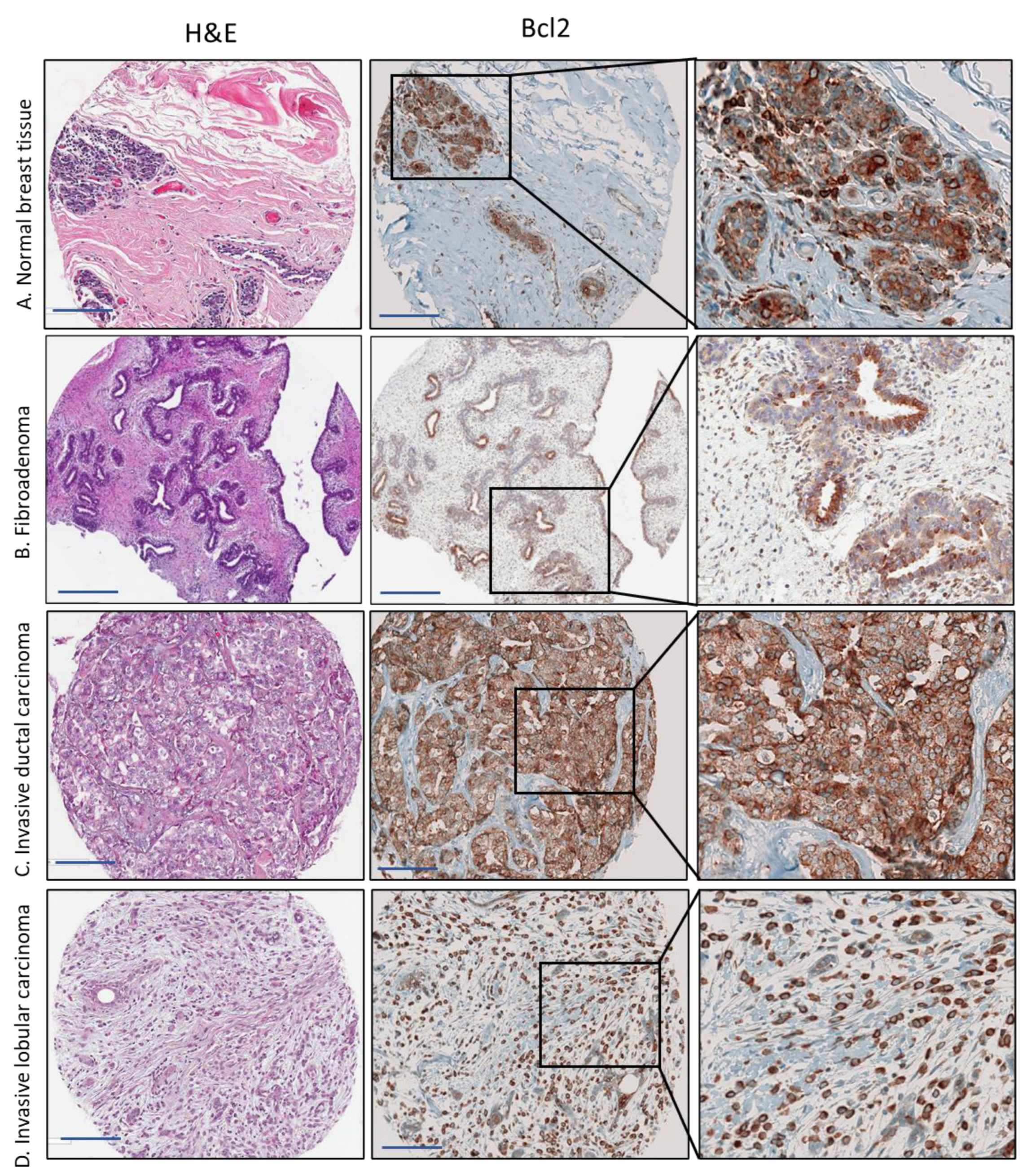 Cancers 15 03151 g003