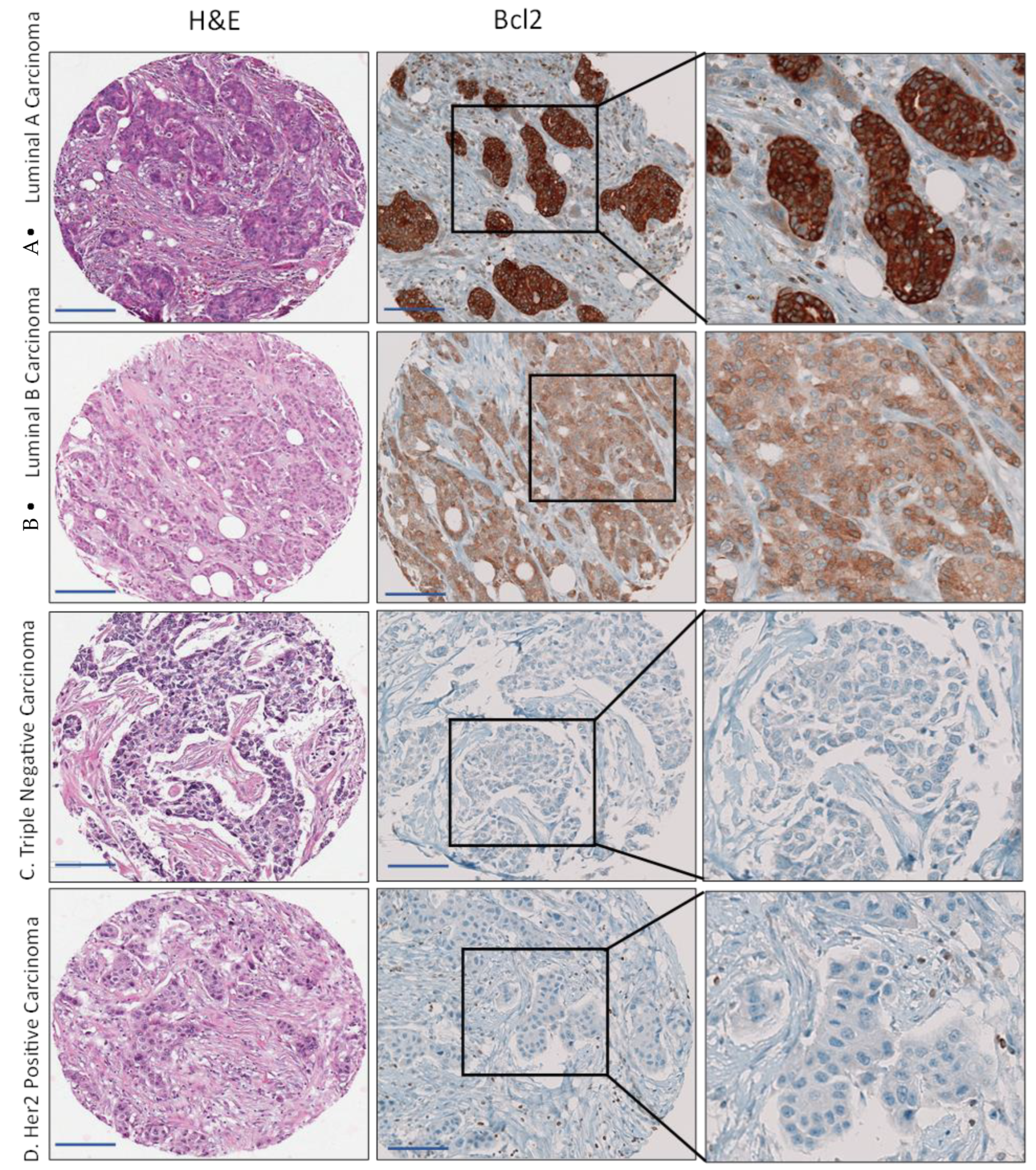 Cancers 15 03151 g004