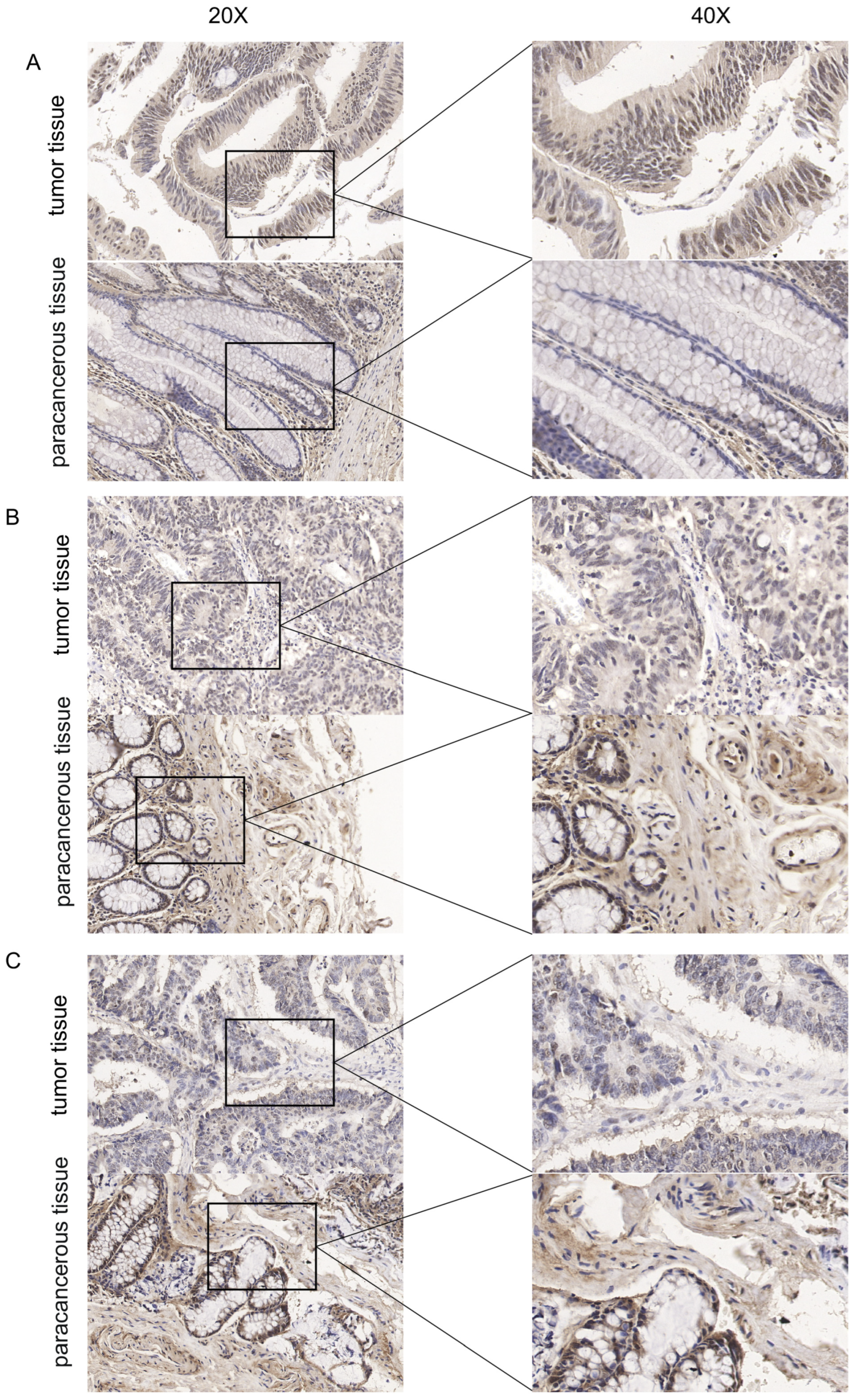 Cancers 15 03185 g005