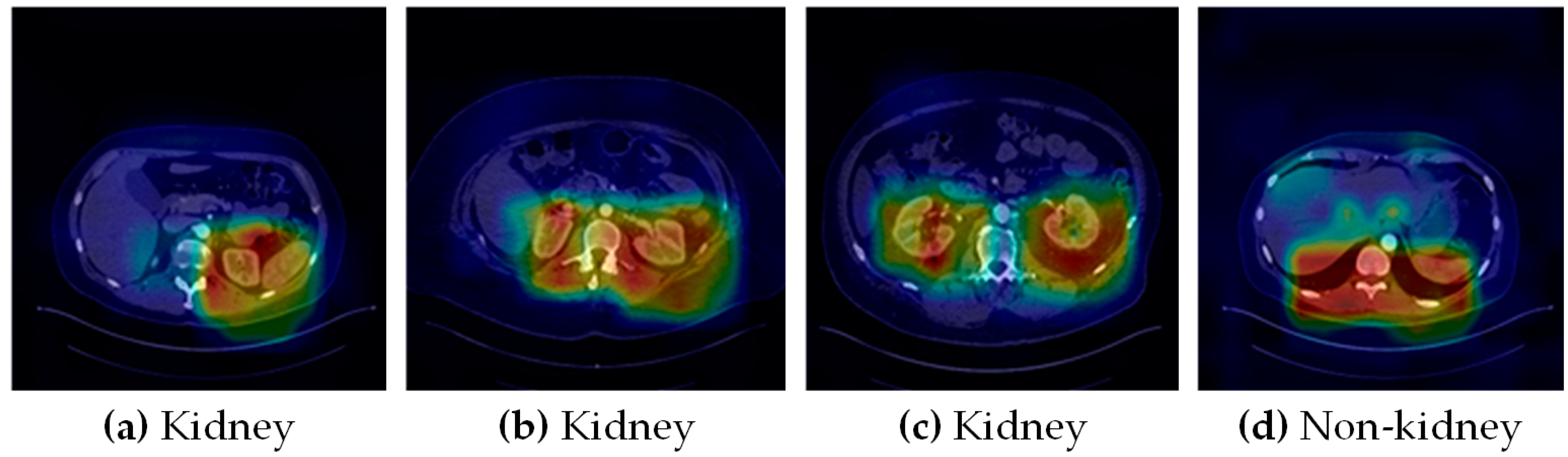 Cancers 15 03189 g005 Cancers 15 03189 g005
