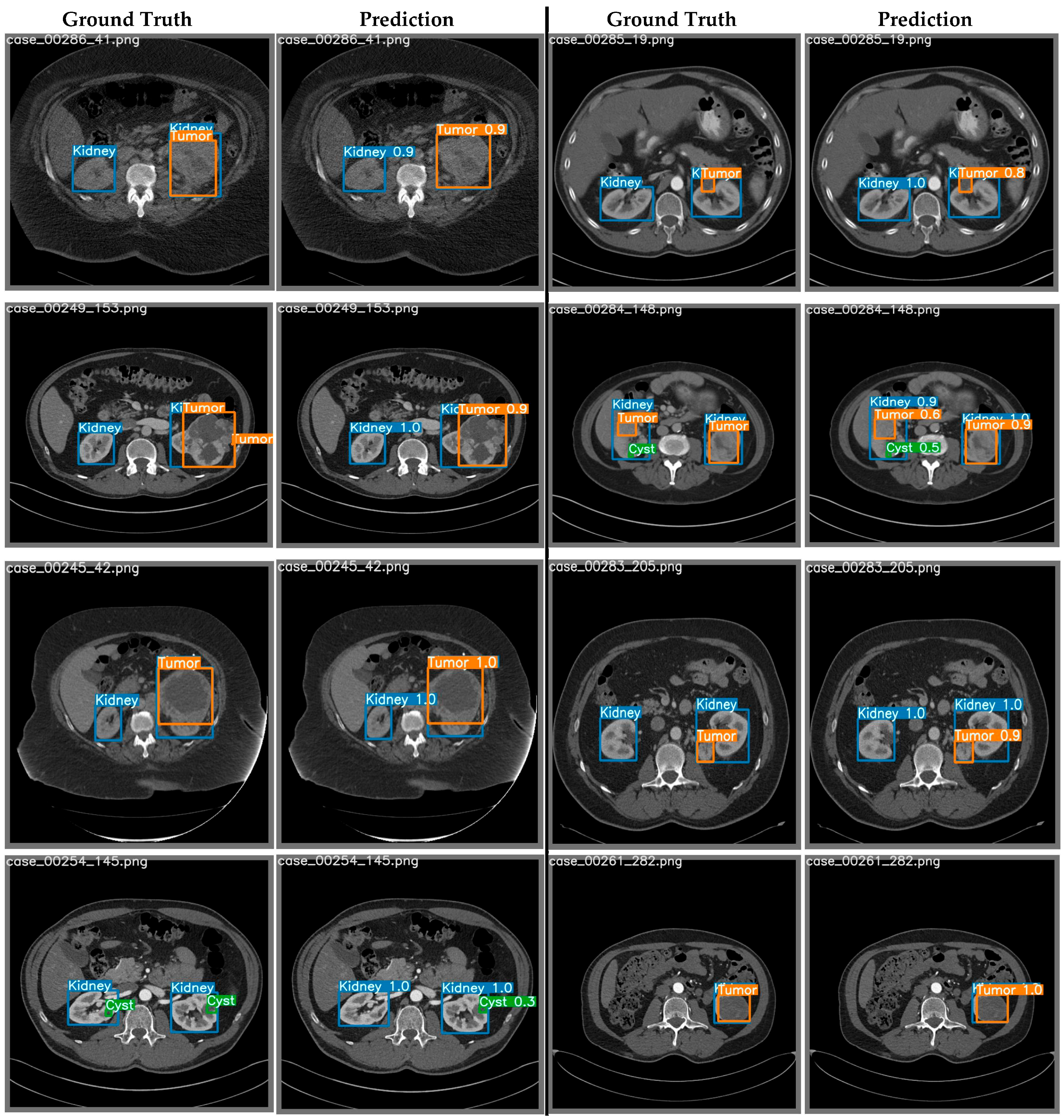 Cancers 15 03189 g006 Cancers 15 03189 g006