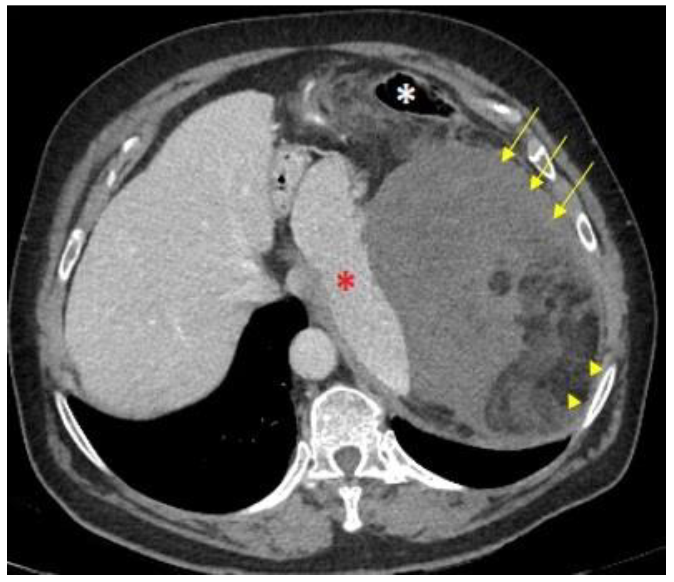 Cancers 15 03194 g001 Cancers 15 03194 g001