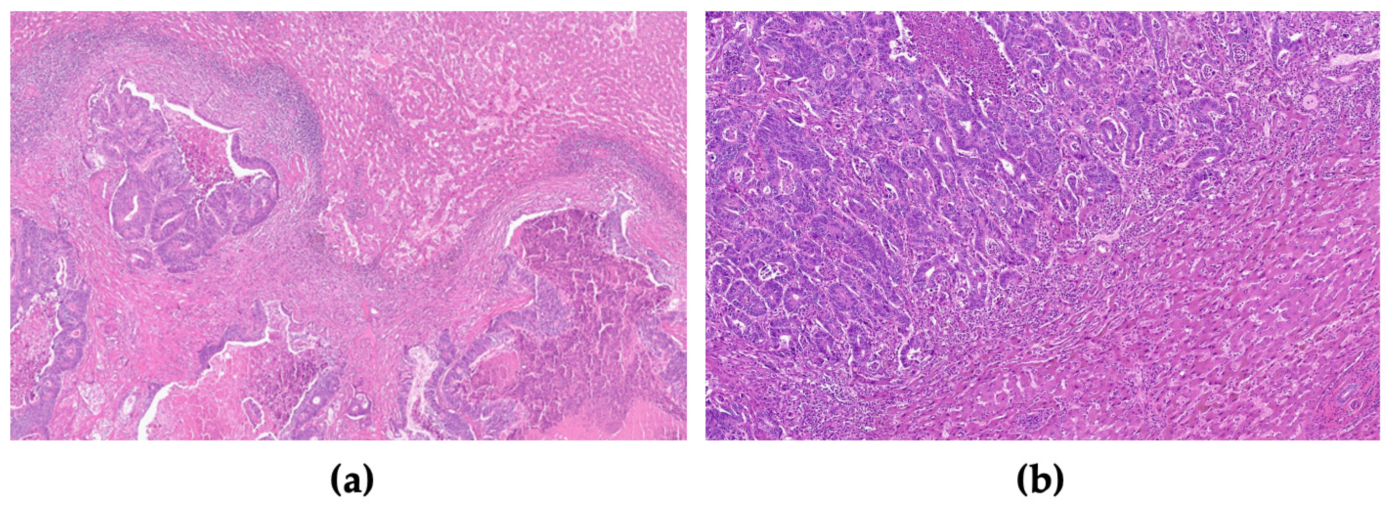 Cancers 15 03222 g001 Cancers 15 03222 g001