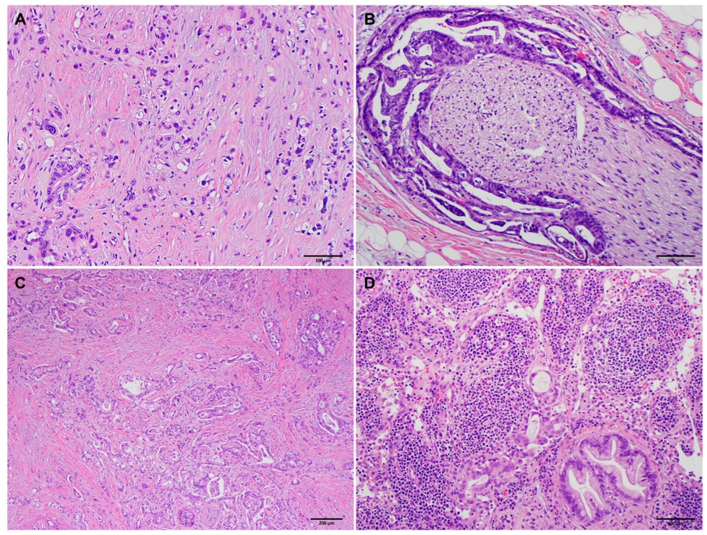 Cancers 15 03231 g001 Cancers 15 03231 g001