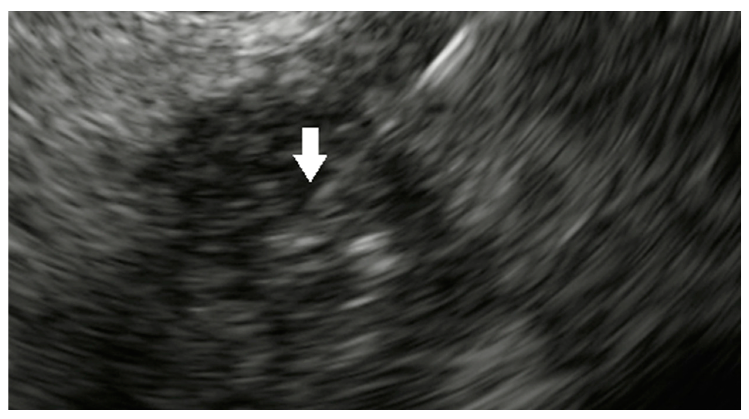 Cancers 15 03235 g001 Cancers 15 03235 g001