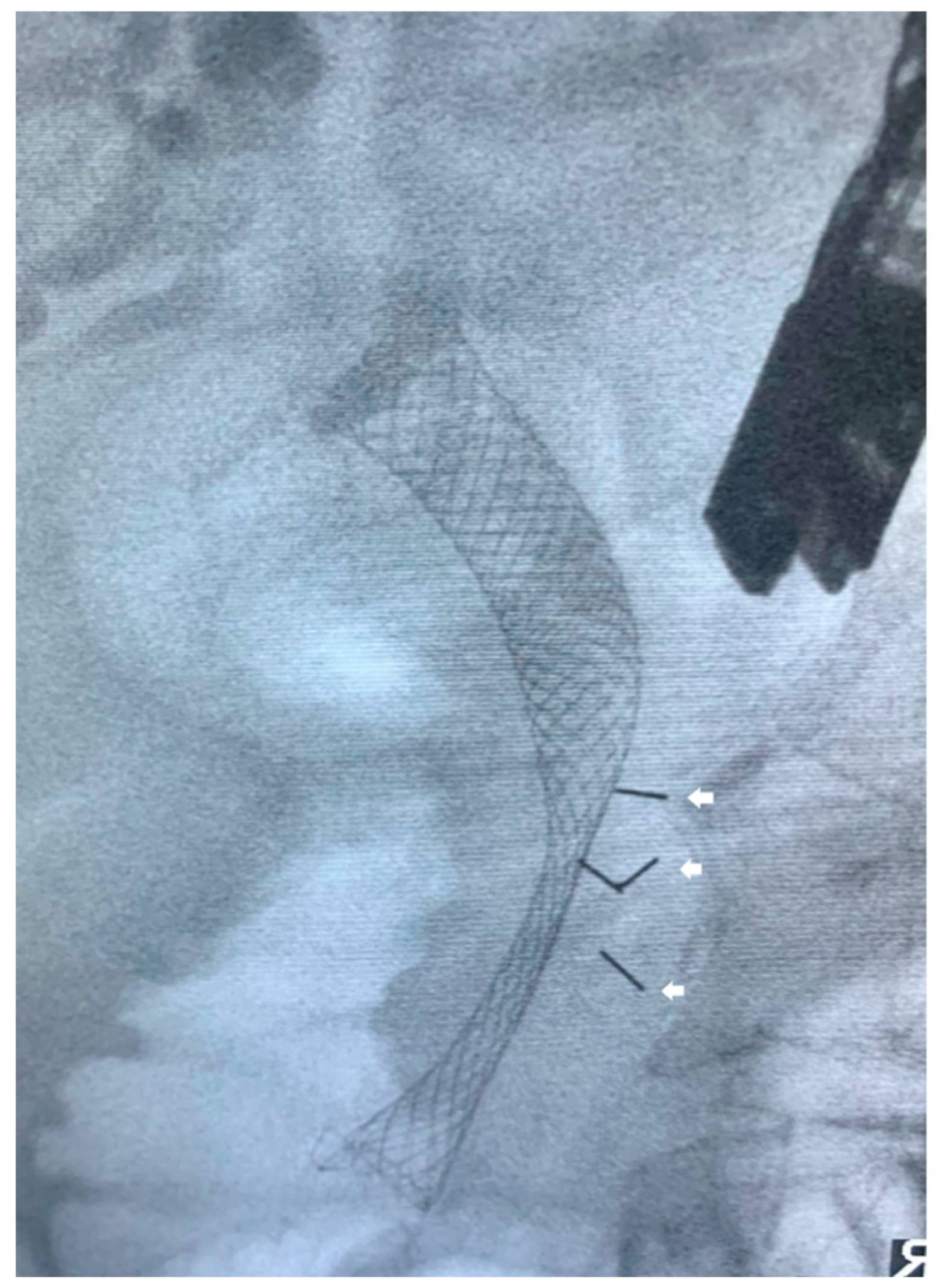 Cancers 15 03235 g002 Cancers 15 03235 g002