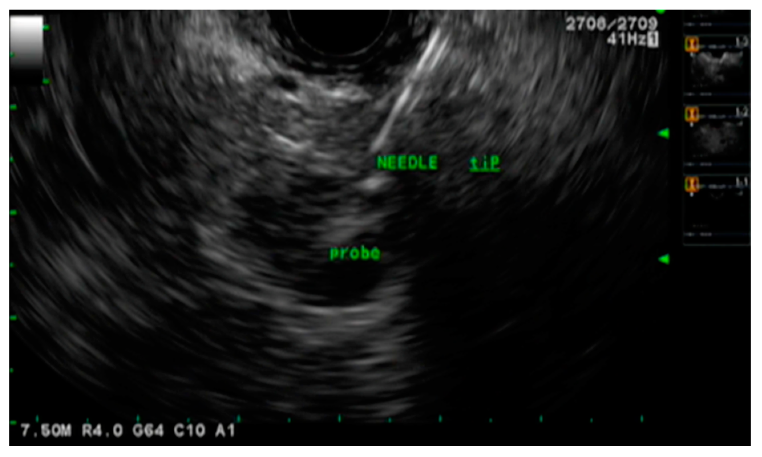 Cancers 15 03235 g003 Cancers 15 03235 g003