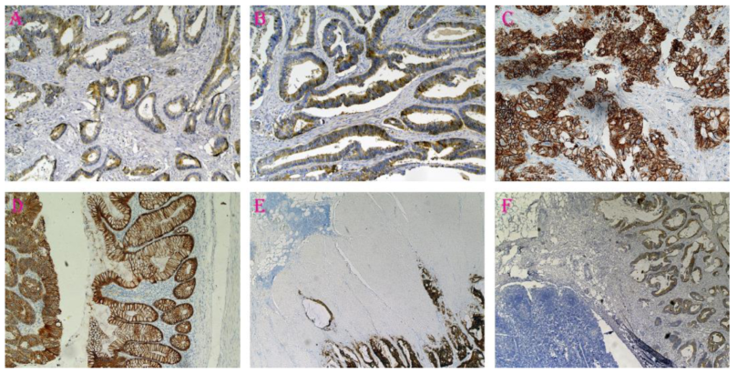 Cancers 15 03260 g001 Cancers 15 03260 g001