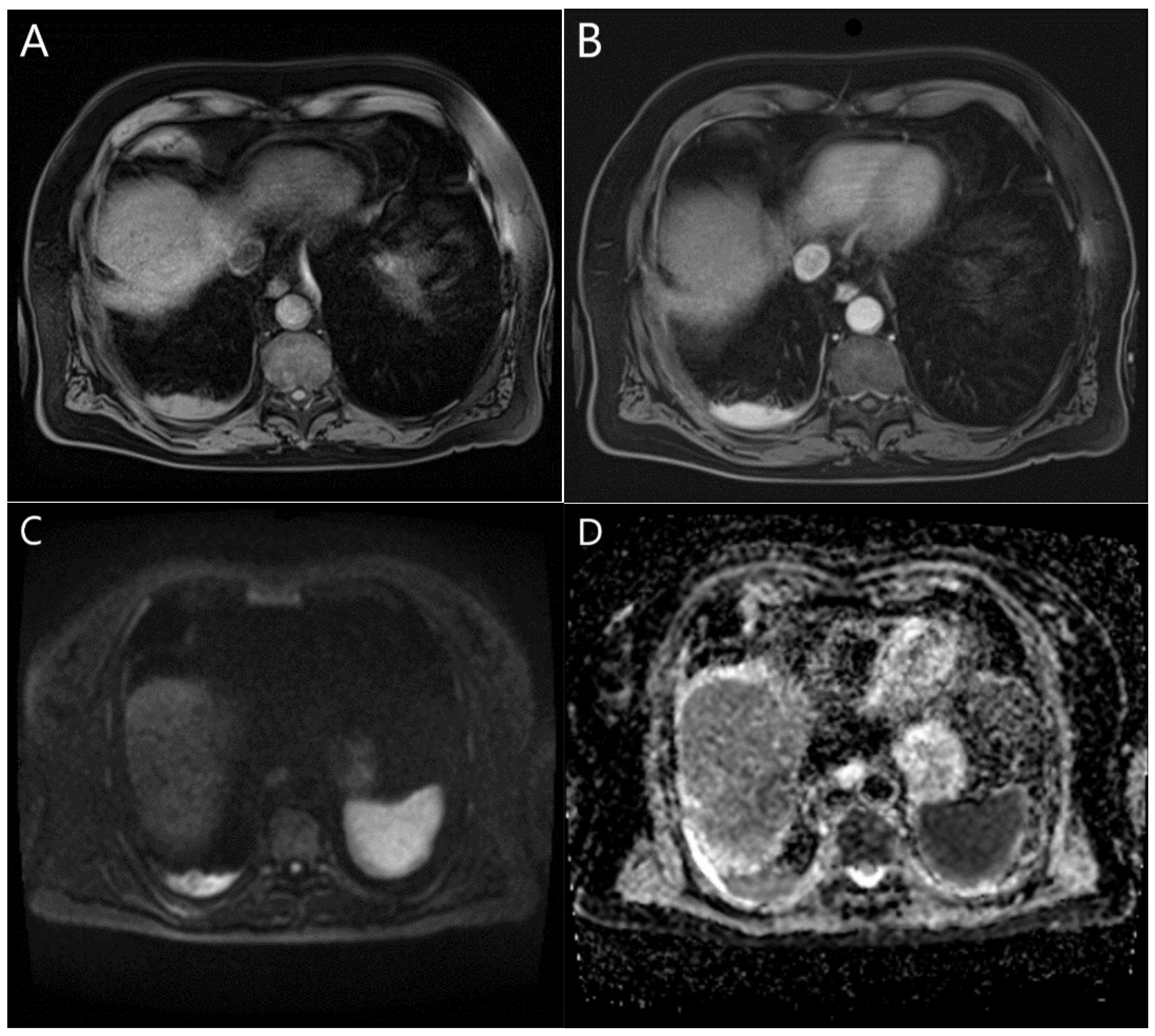 Cancers 15 03261 g001 Cancers 15 03261 g001