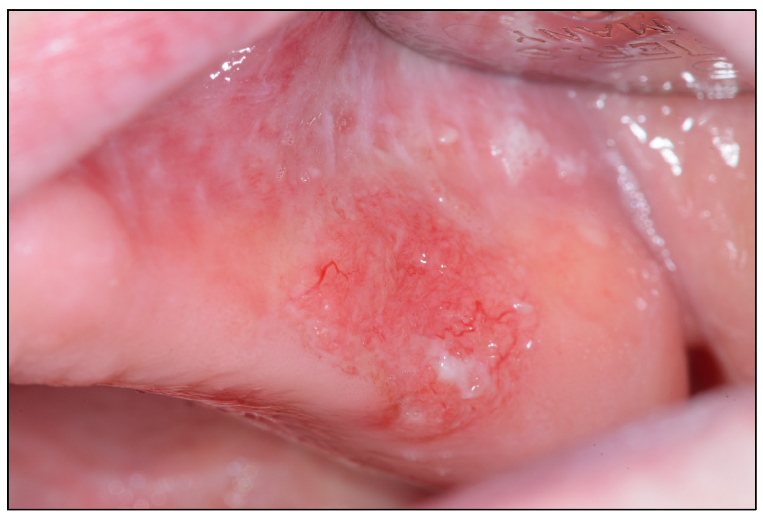 Cancers 15 03270 g001 Cancers 15 03270 g001