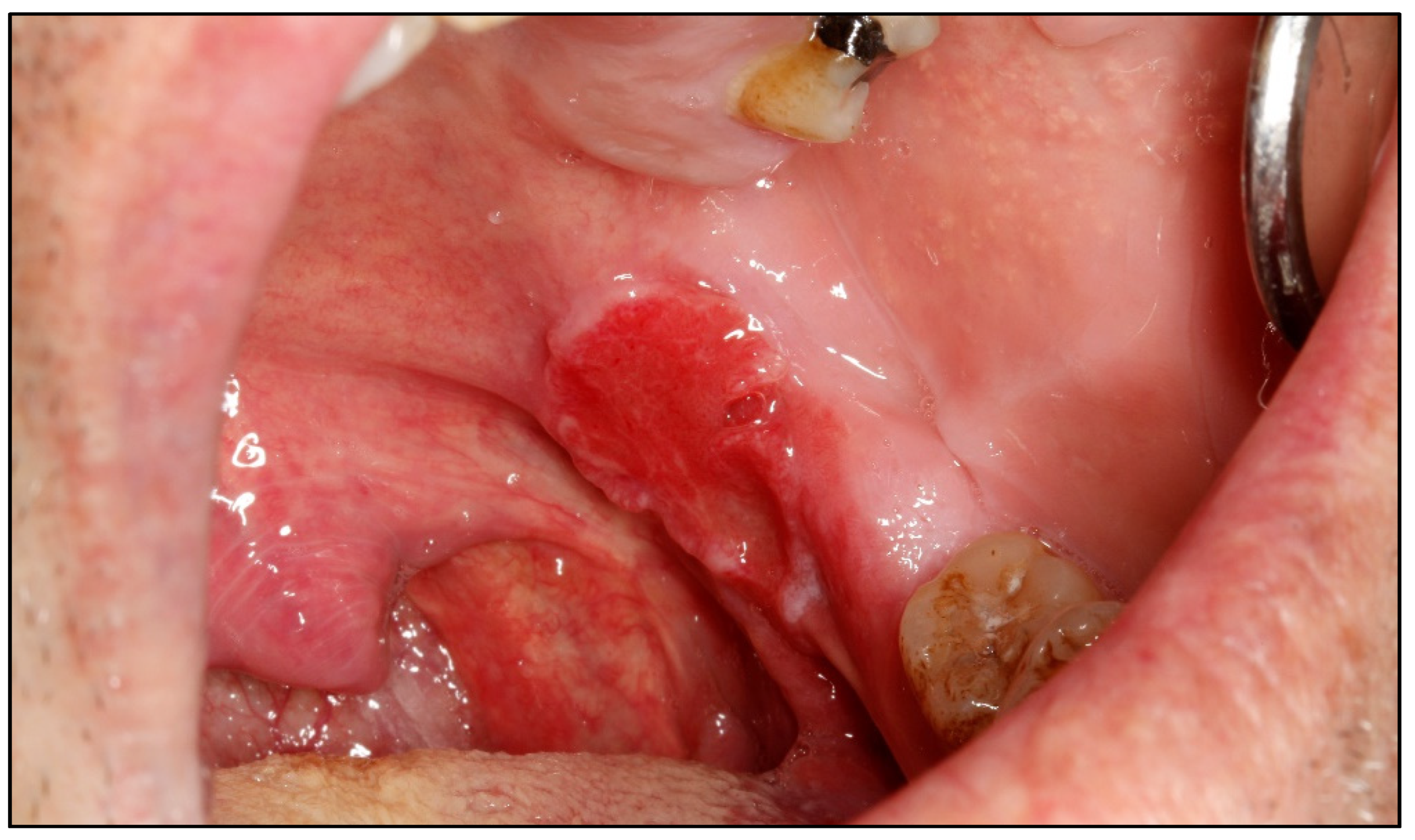 Cancers 15 03270 g002 Cancers 15 03270 g002