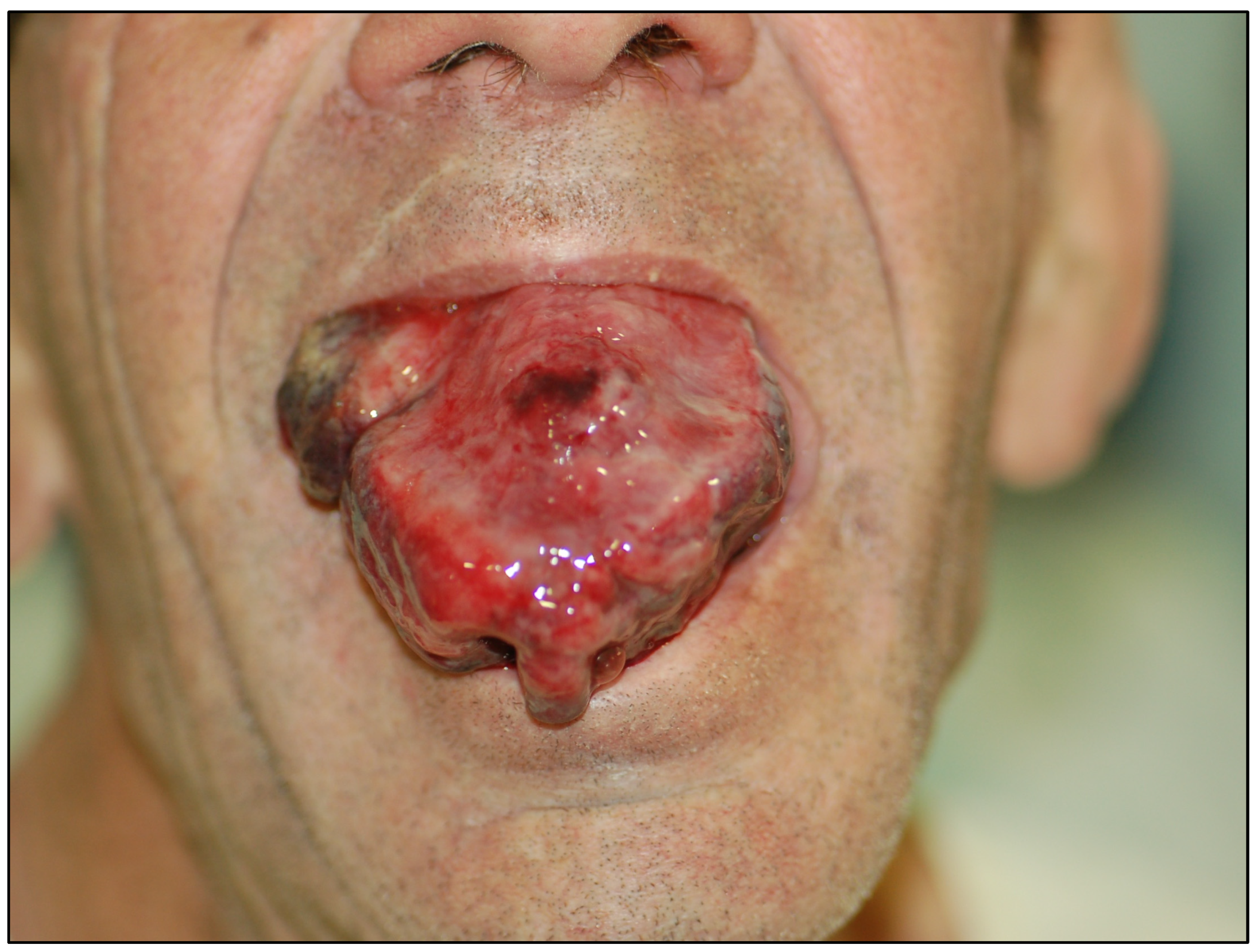 Cancers 15 03270 g005 Cancers 15 03270 g005