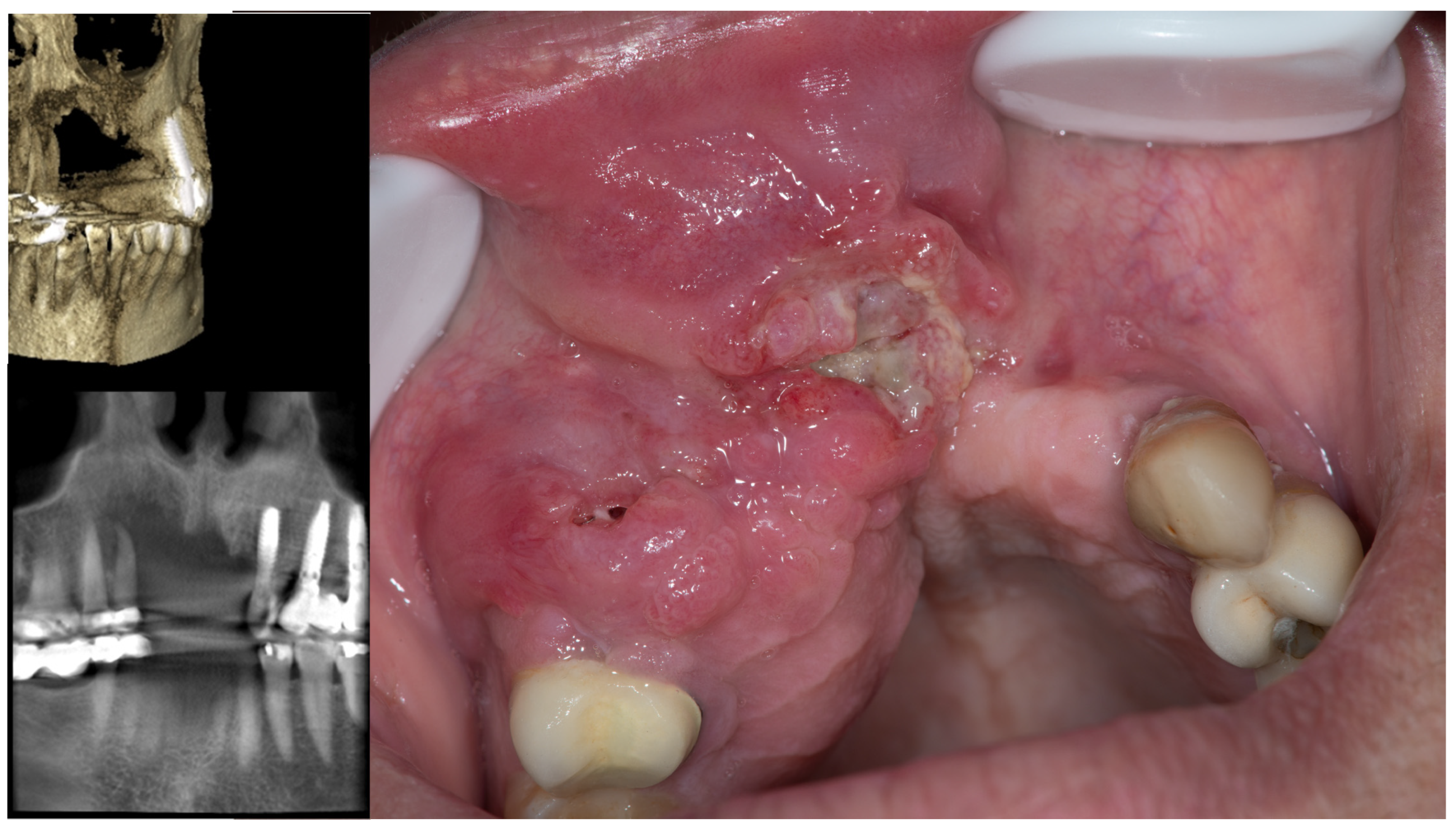 Cancers 15 03270 g006 Cancers 15 03270 g006