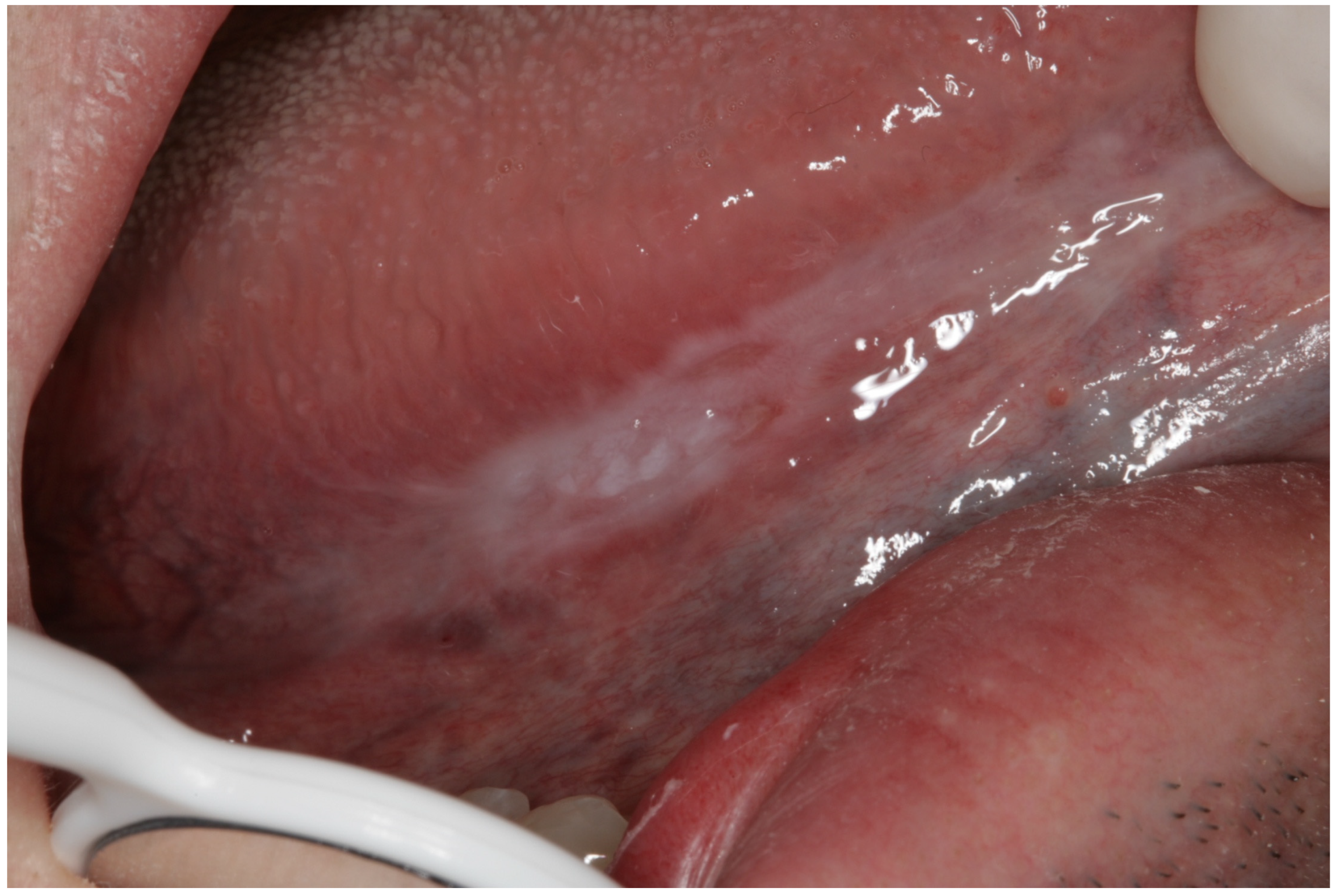 Cancers 15 03270 g0a10 Cancers 15 03270 g0a10