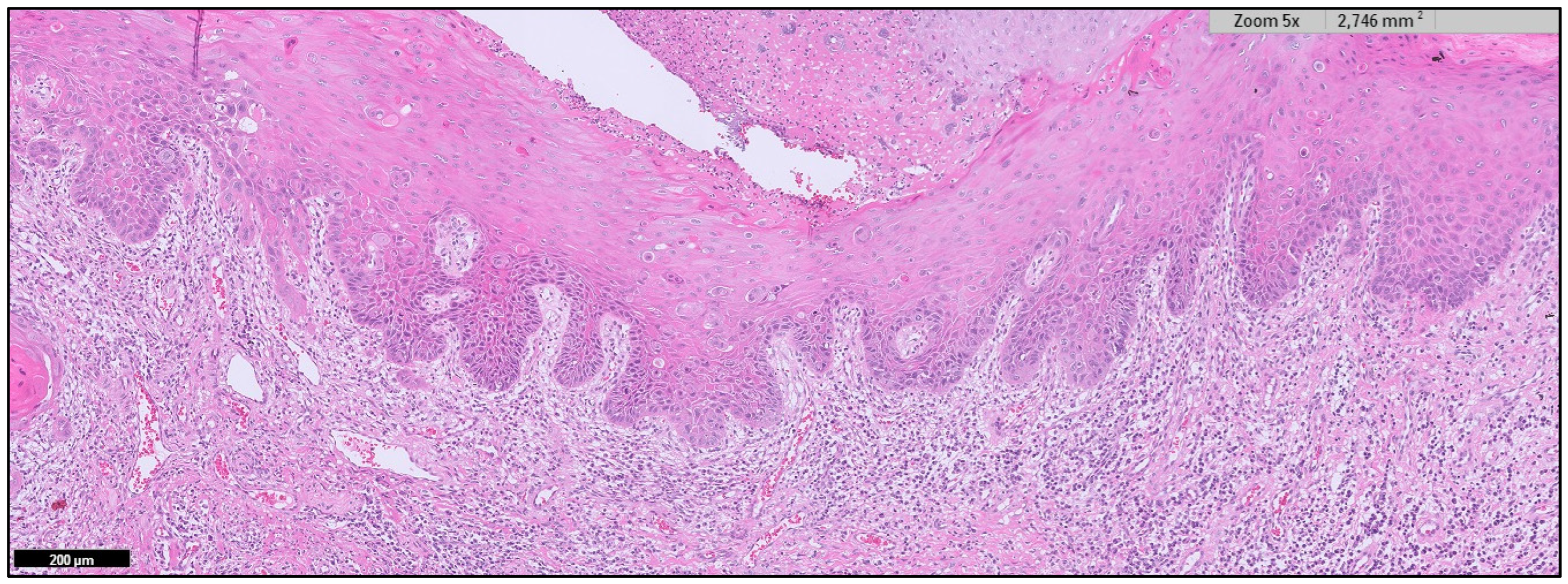 Cancers 15 03270 g0a11 Cancers 15 03270 g0a11