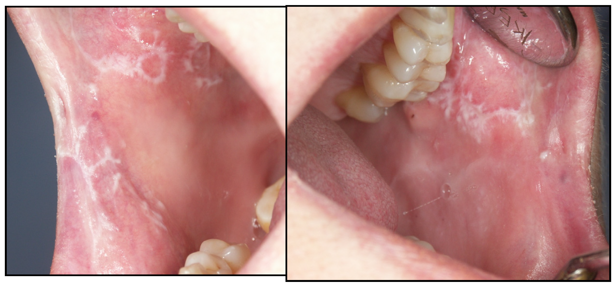 Cancers 15 03270 g0a12 Cancers 15 03270 g0a12