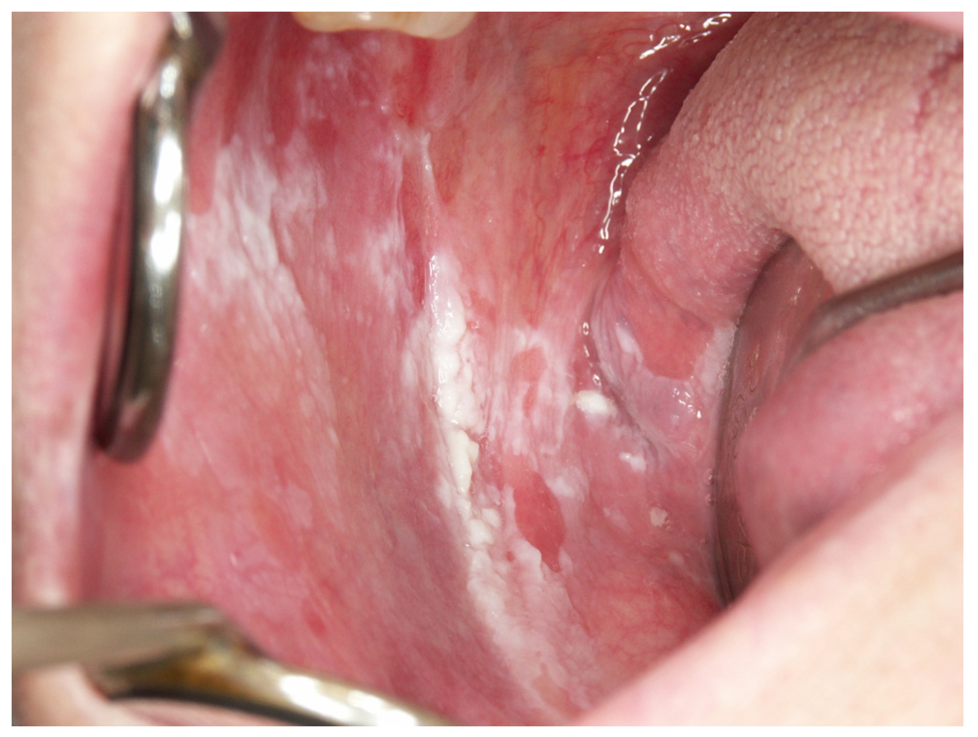 Cancers 15 03270 g0a14 Cancers 15 03270 g0a14