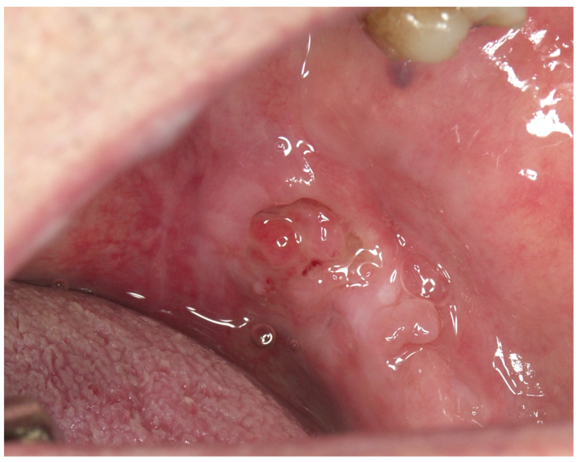 Cancers 15 03270 g0a16 Cancers 15 03270 g0a16