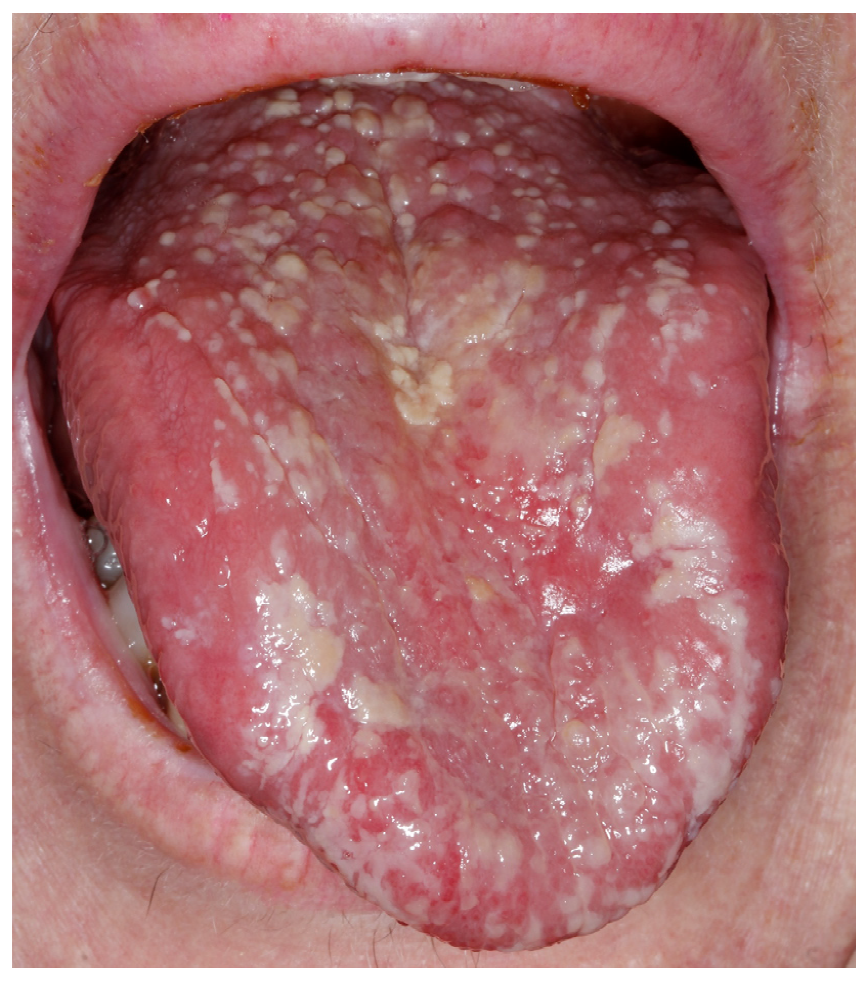 Cancers 15 03270 g0a2 Cancers 15 03270 g0a2