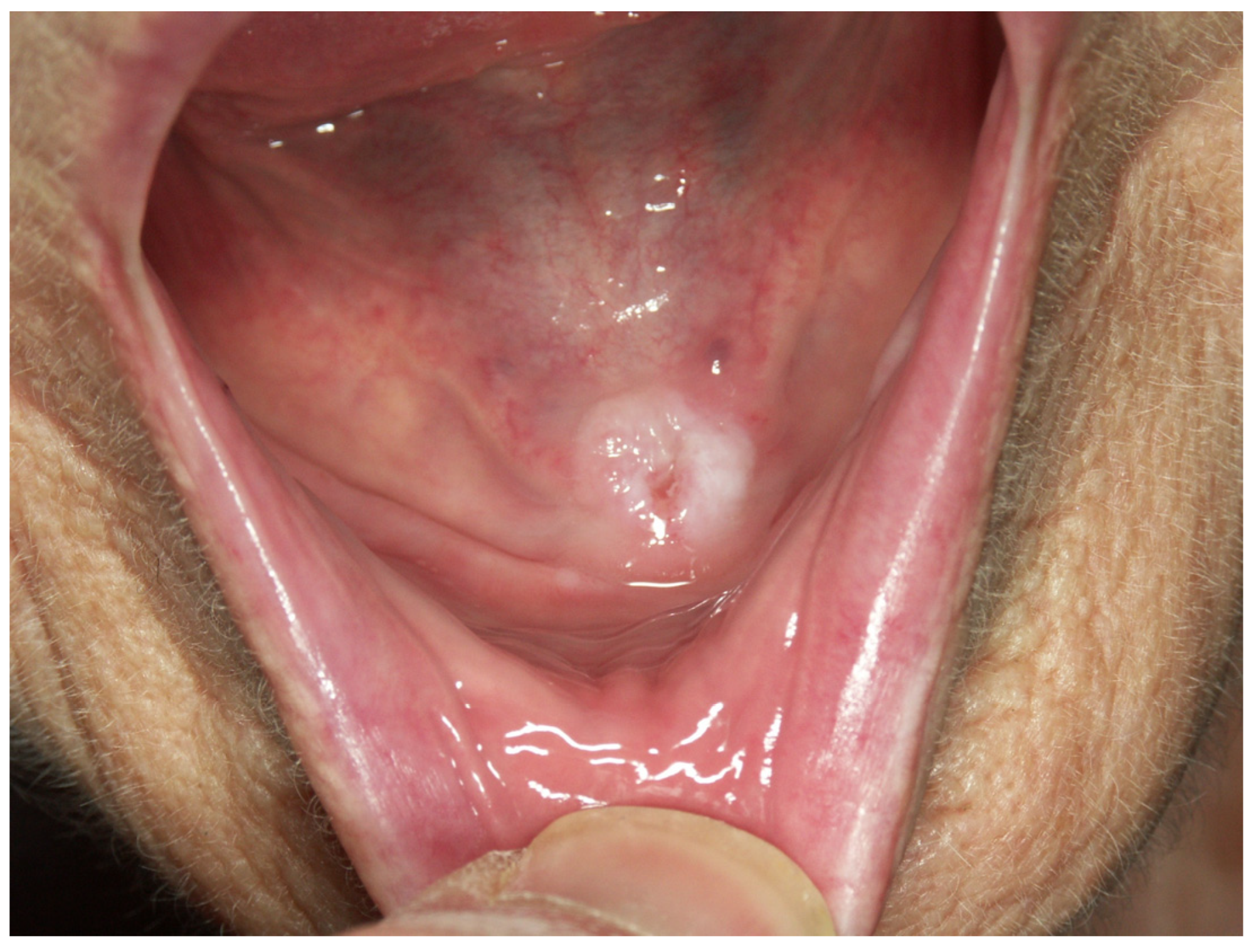 Cancers | Free Full-Text | Early Diagnosis of Oral Cancer: A Complex  Polyhedral Problem with a Difficult Solution