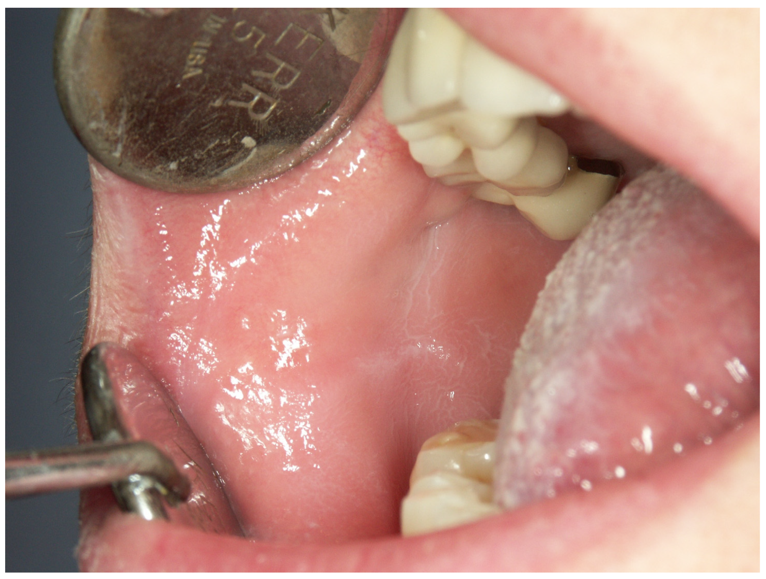 Cancers 15 03270 g0a5 Cancers 15 03270 g0a5