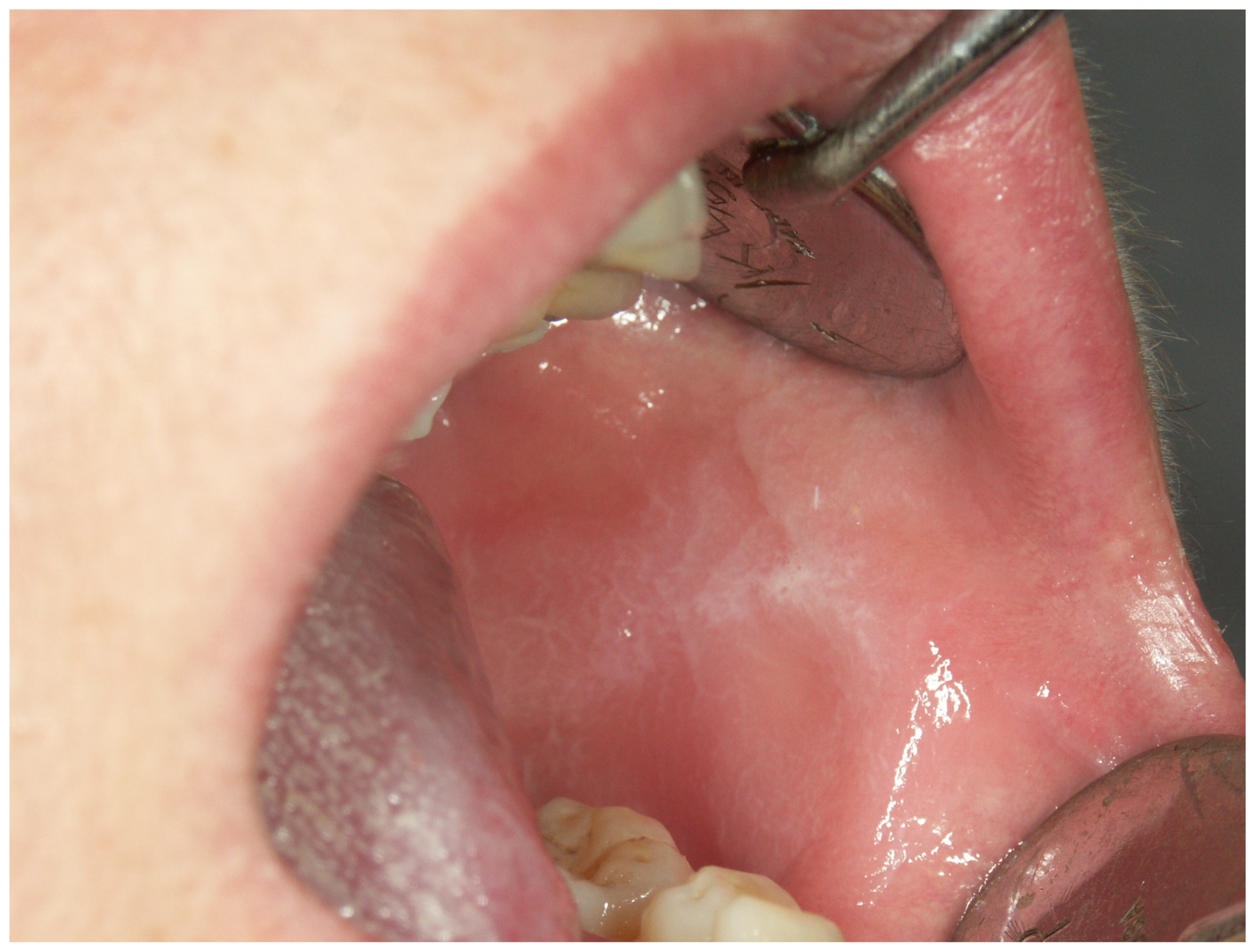 Cancers 15 03270 g0a6 Cancers 15 03270 g0a6