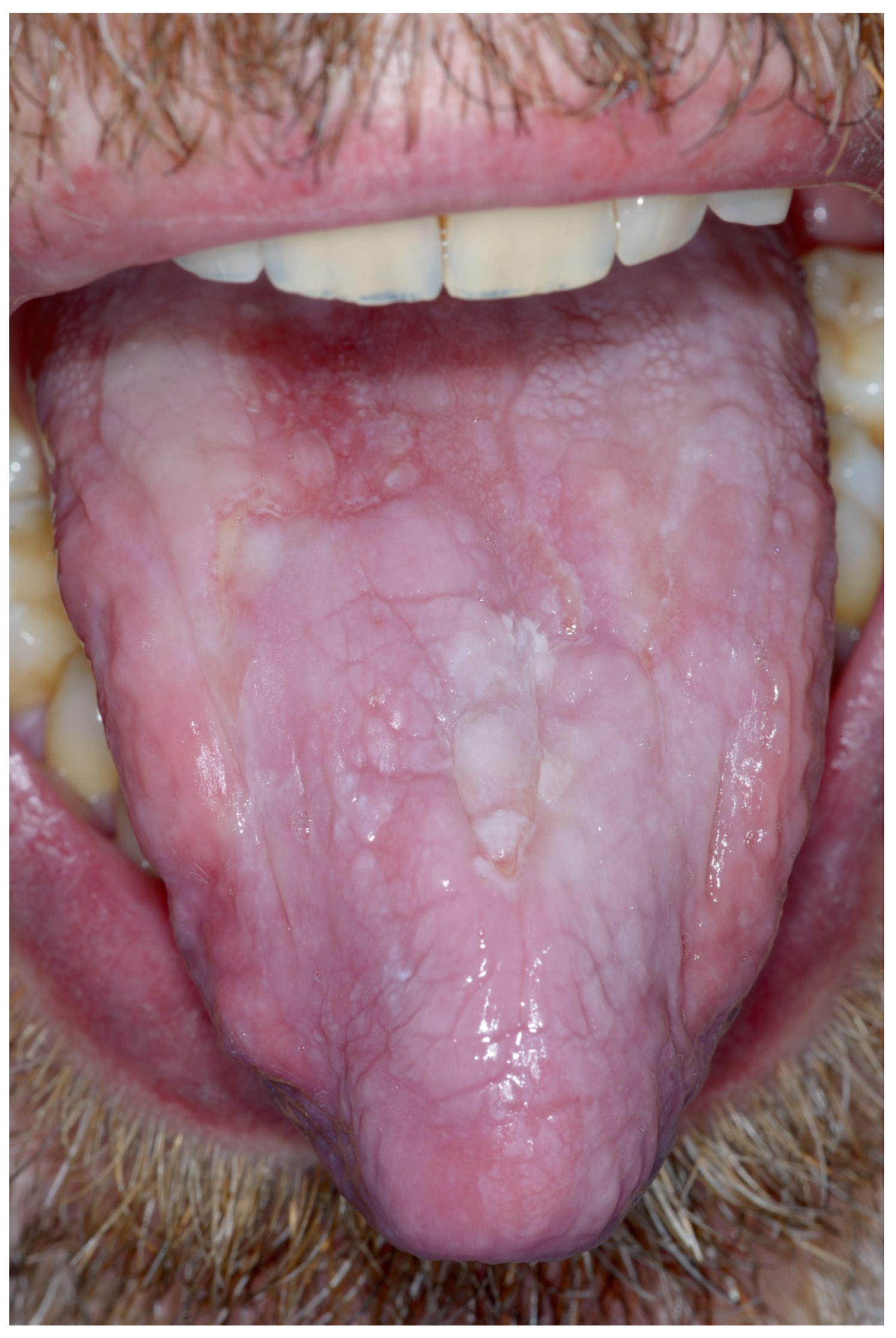 Cancers 15 03270 g0a8 Cancers 15 03270 g0a8