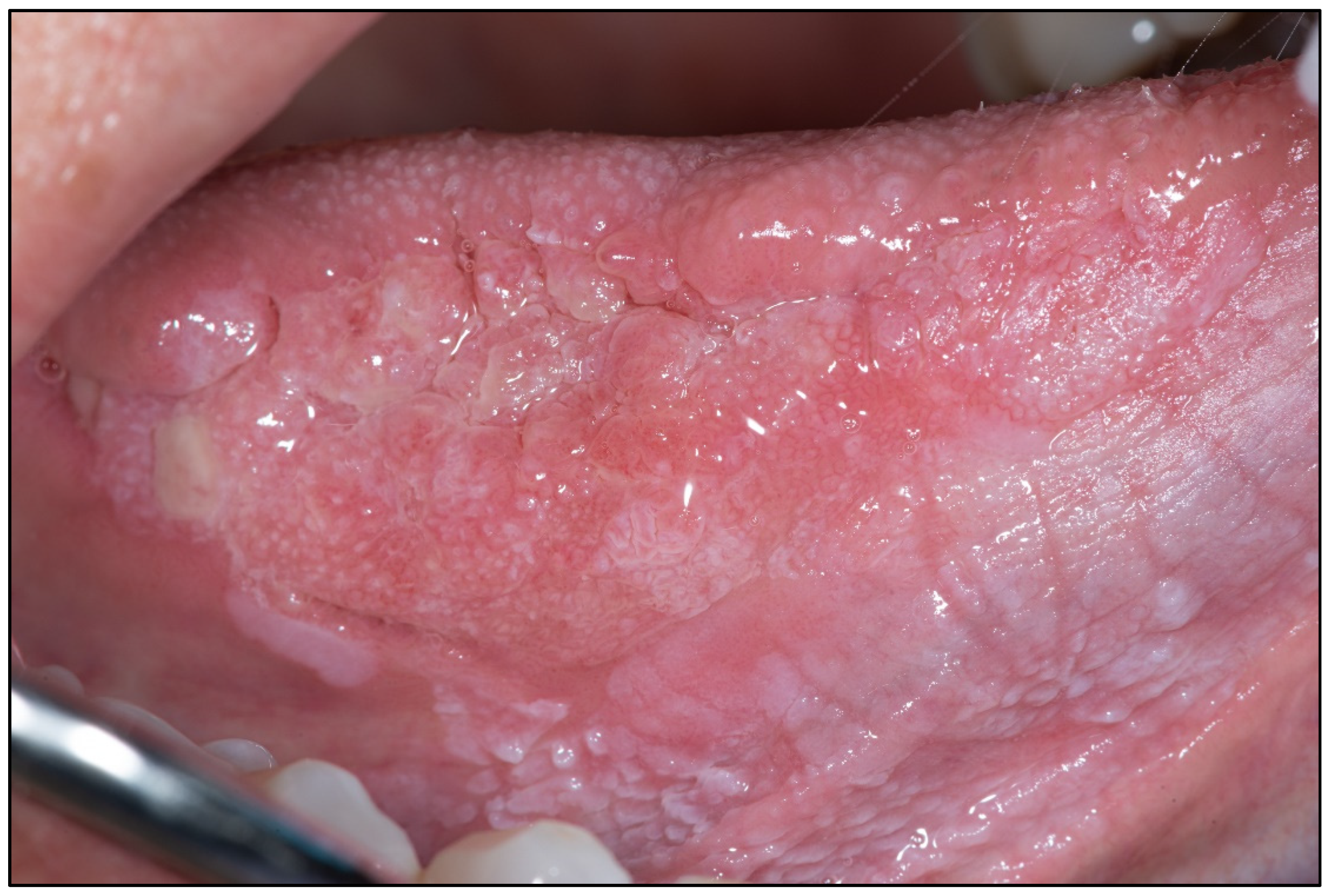 Cancers 15 03270 g0a9 Cancers 15 03270 g0a9