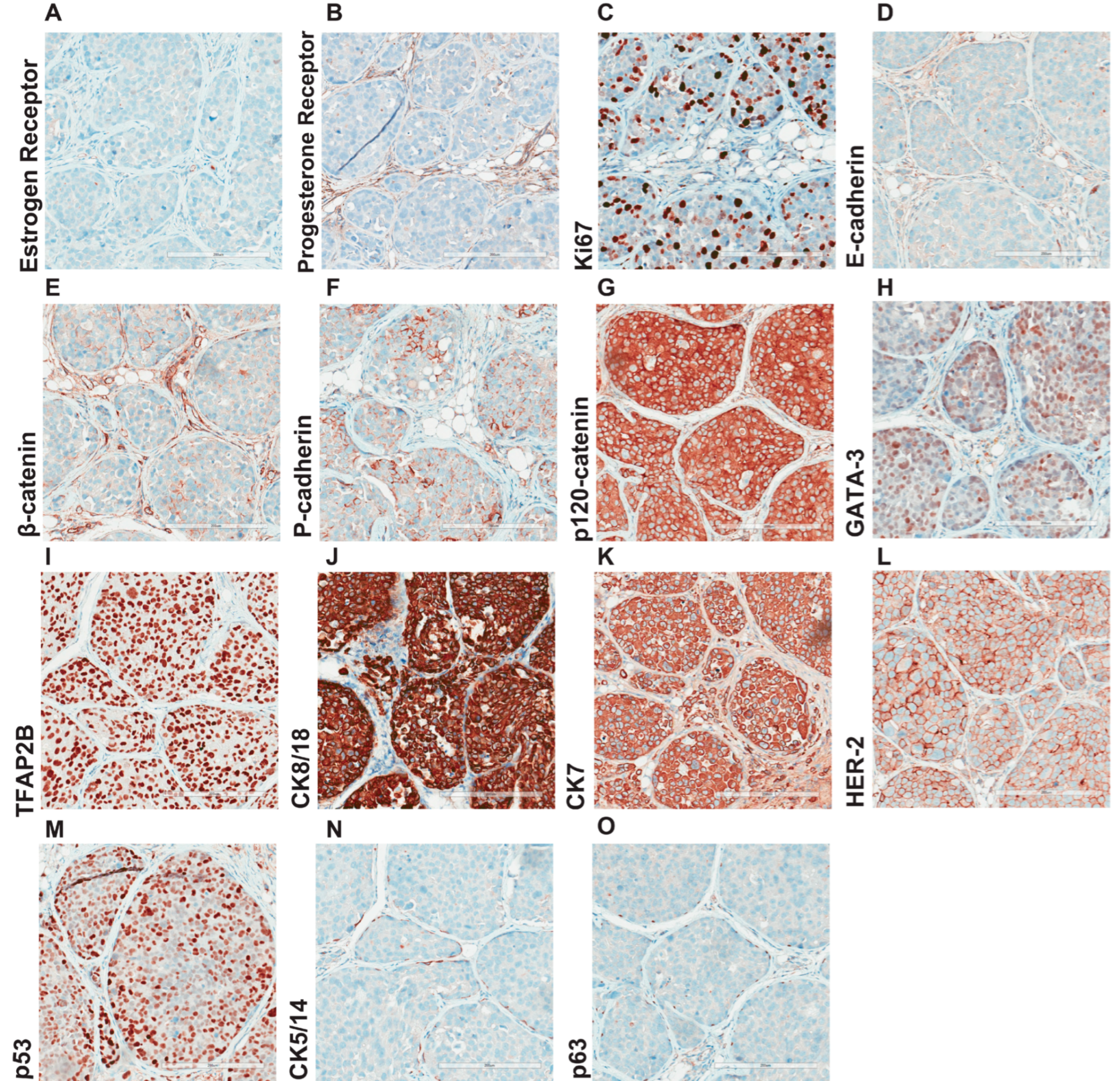 Cancers 15 03299 g004 Cancers 15 03299 g004