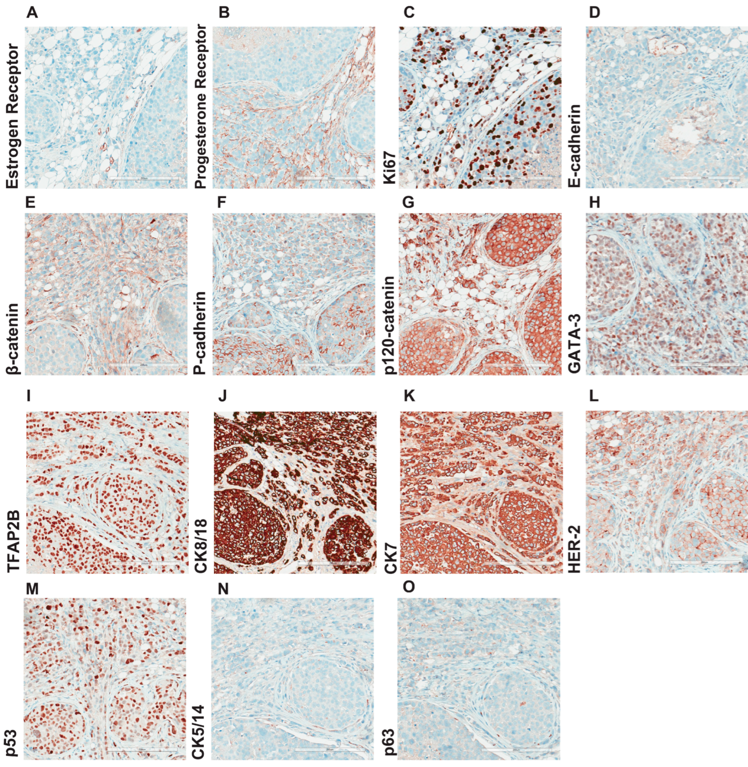 Cancers 15 03299 g005 Cancers 15 03299 g005