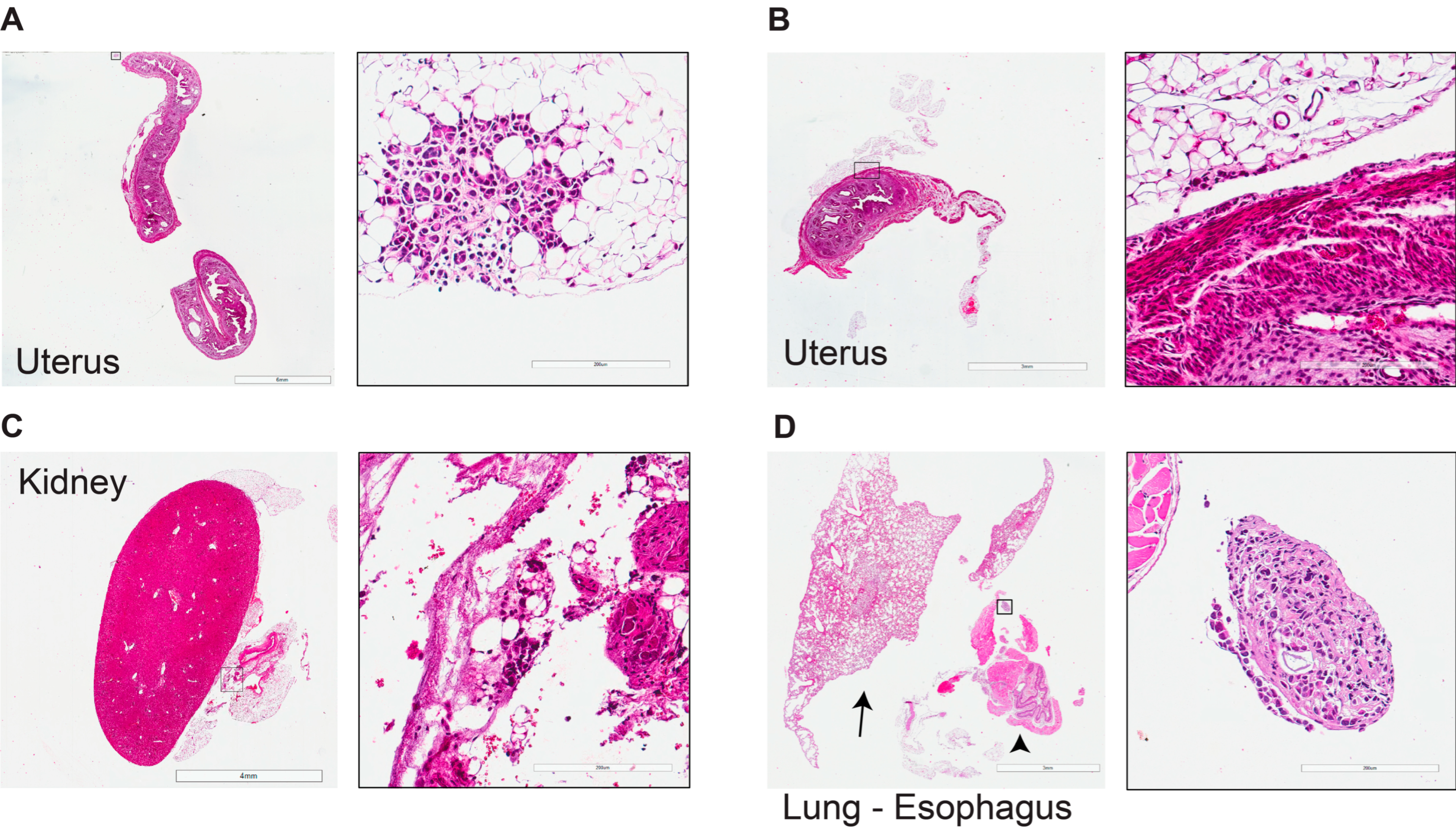 Optimized Modeling of Metastatic Triple-Negative Invasive