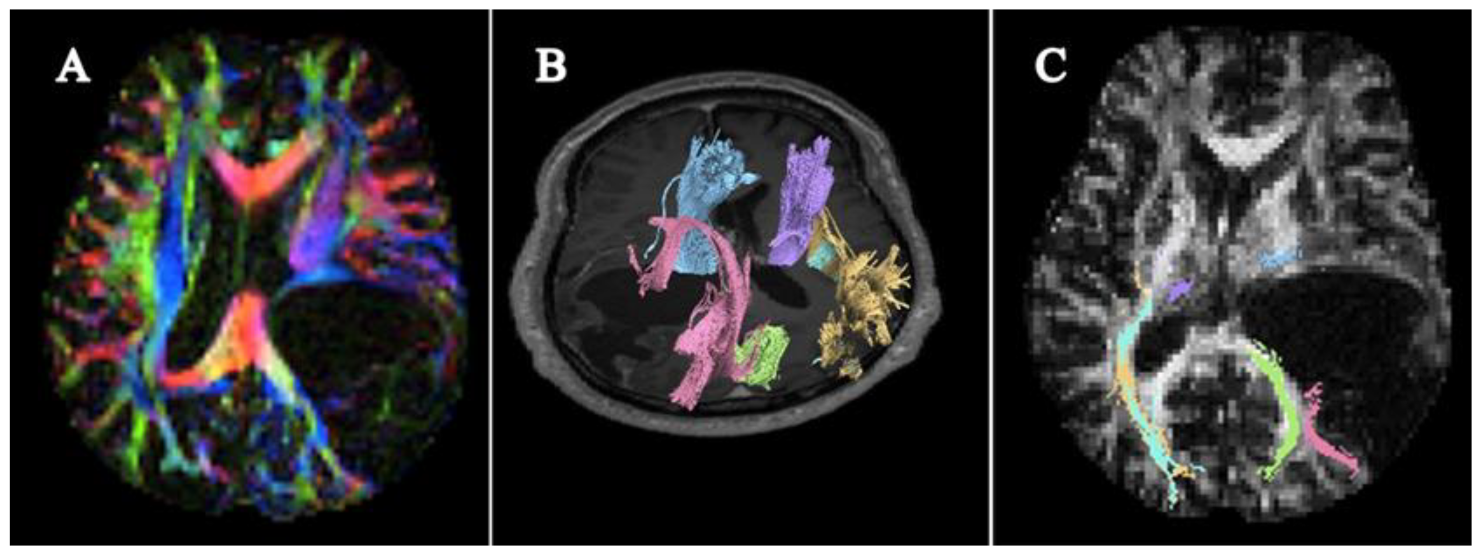 Cancers 15 03326 g002 Cancers 15 03326 g002
