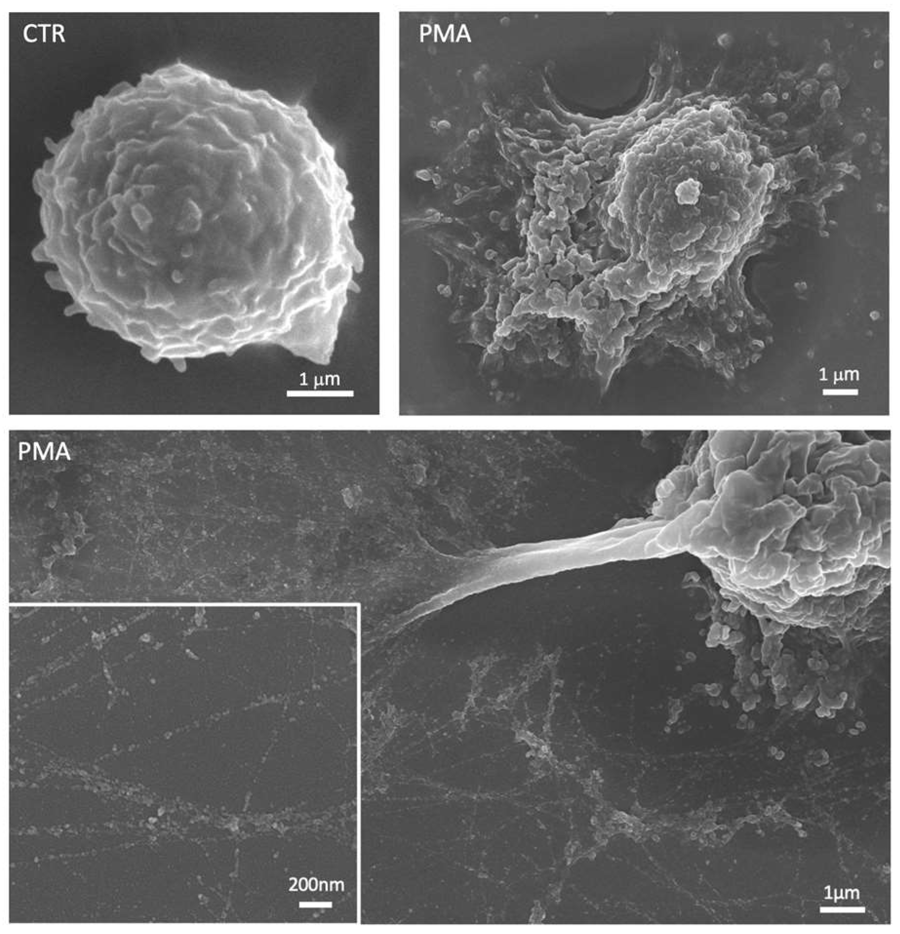 Cancers 15 03327 g002 Cancers 15 03327 g002