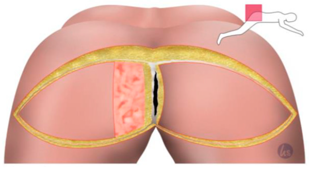 Cancers 15 03345 g002 Cancers 15 03345 g002