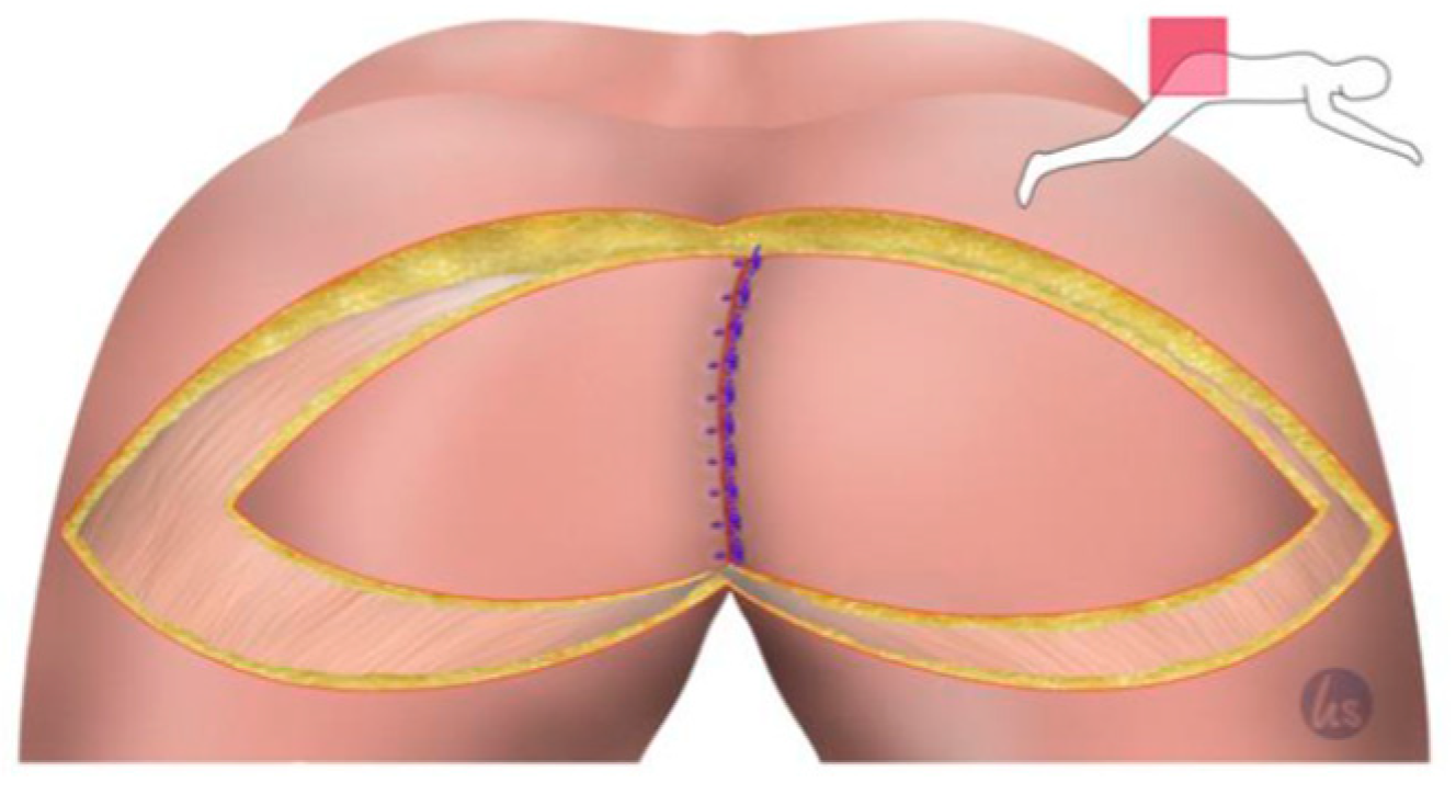 Cancers 15 03345 g003 Cancers 15 03345 g003