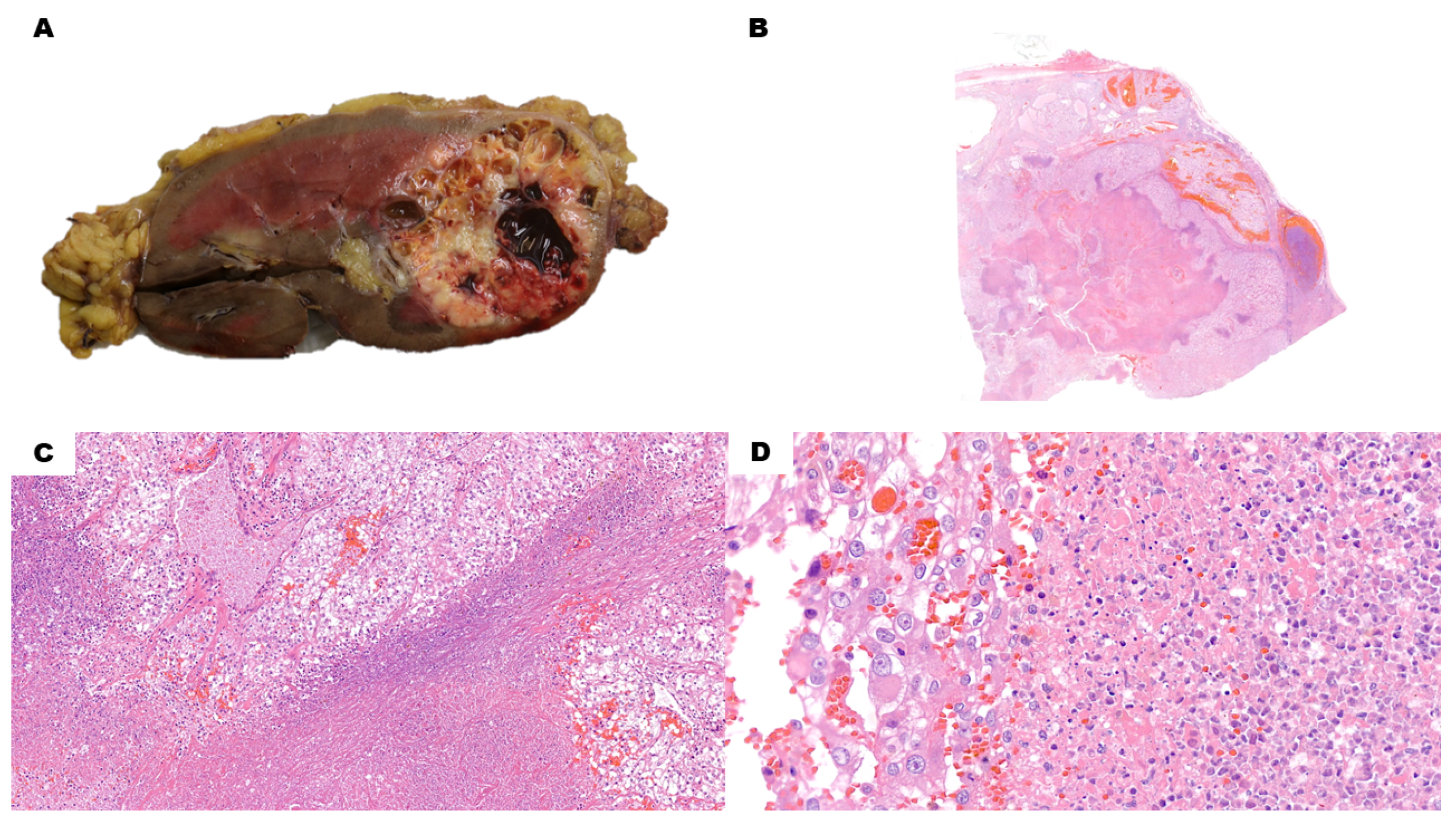 Cancers 15 03352 g002 Cancers 15 03352 g002