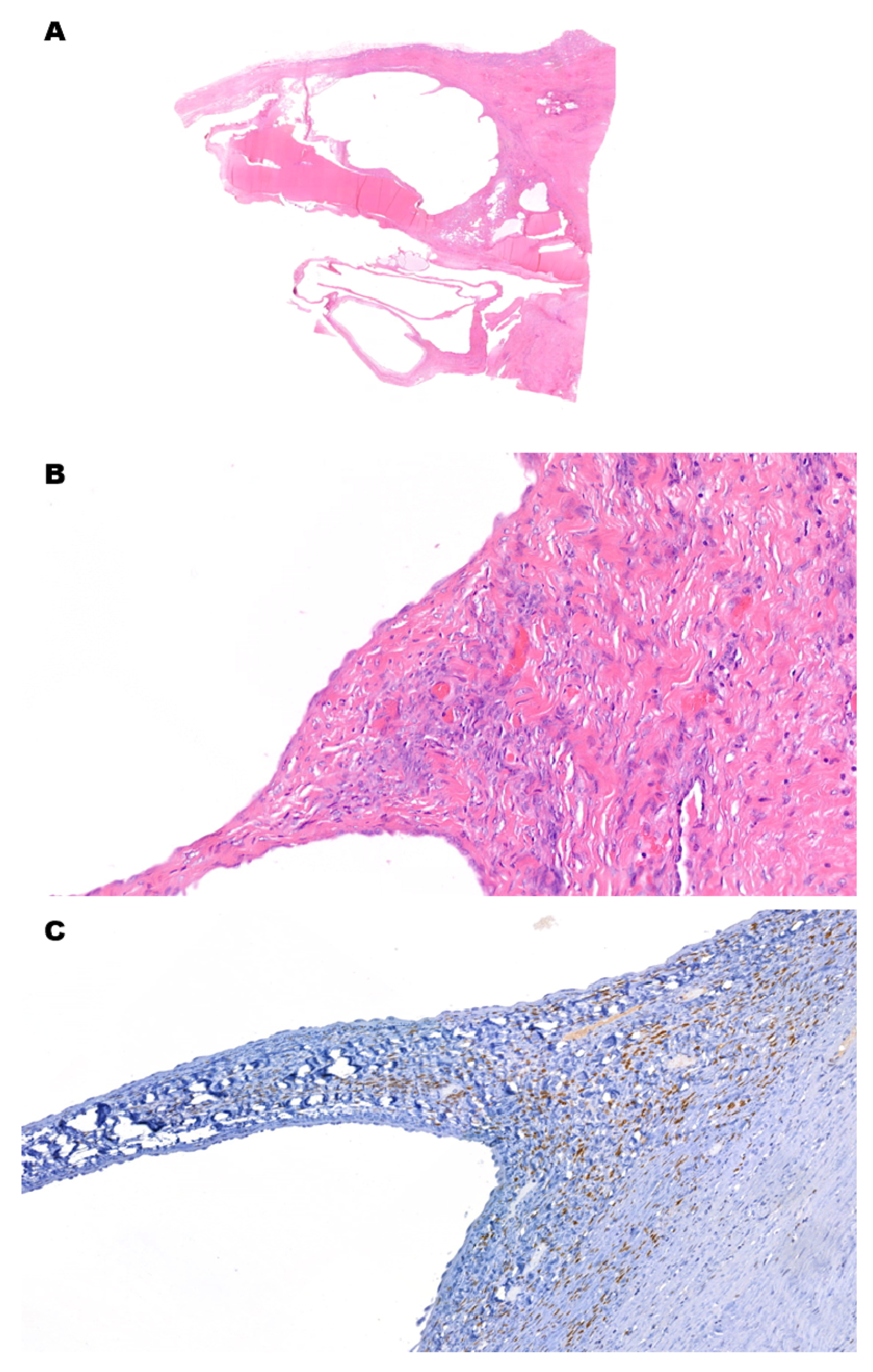 Cancers 15 03352 g004 Cancers 15 03352 g004