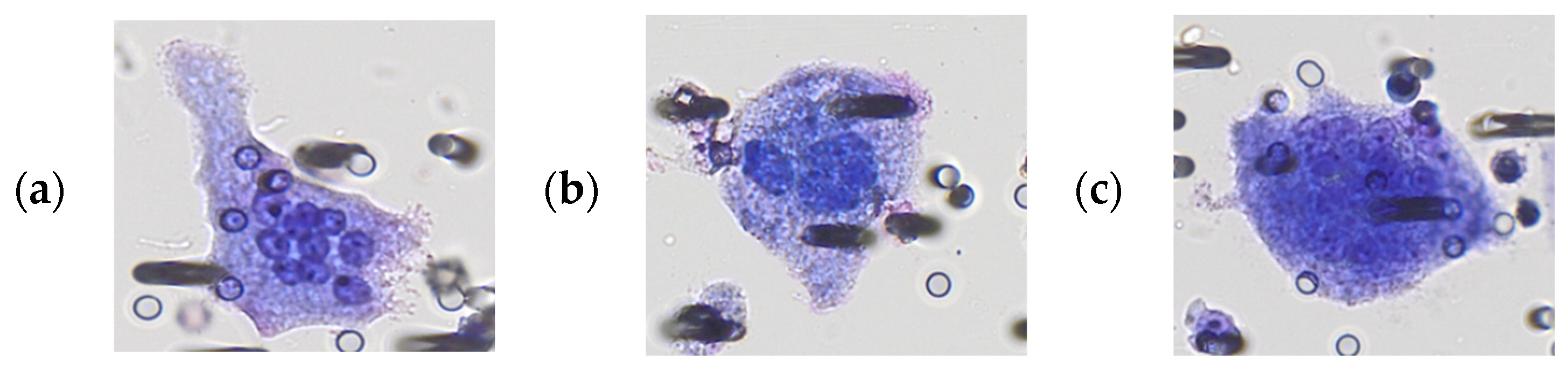 Cancers 15 03366 g001a Cancers 15 03366 g001a