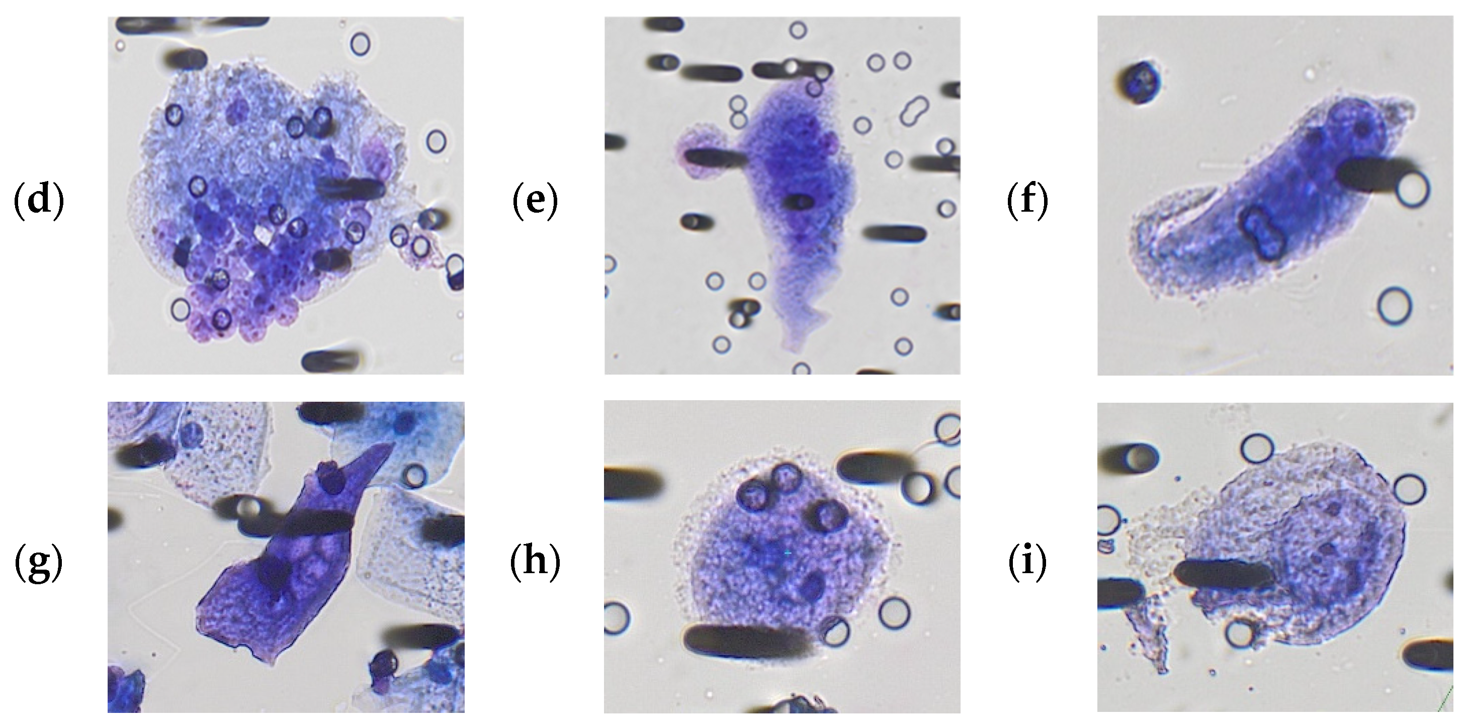 Cancers 15 03366 g001b Cancers 15 03366 g001b