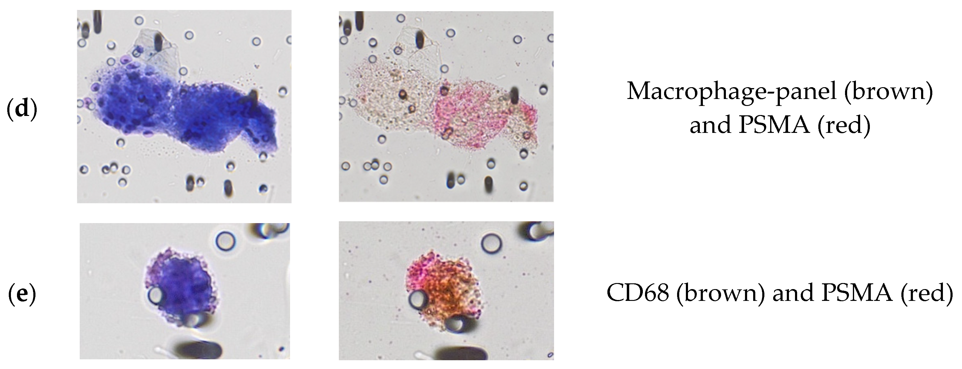 Cancers 15 03366 g003b Cancers 15 03366 g003b