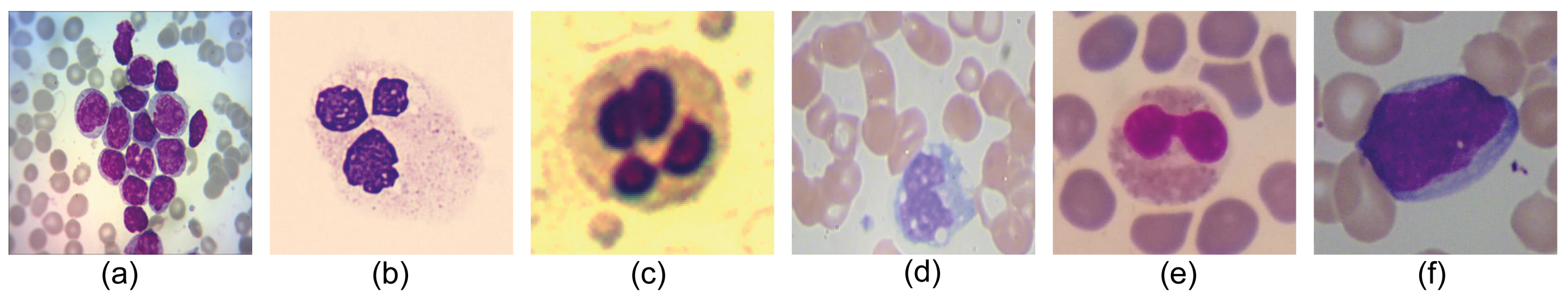 Cancers 15 03376 g001 Cancers 15 03376 g001