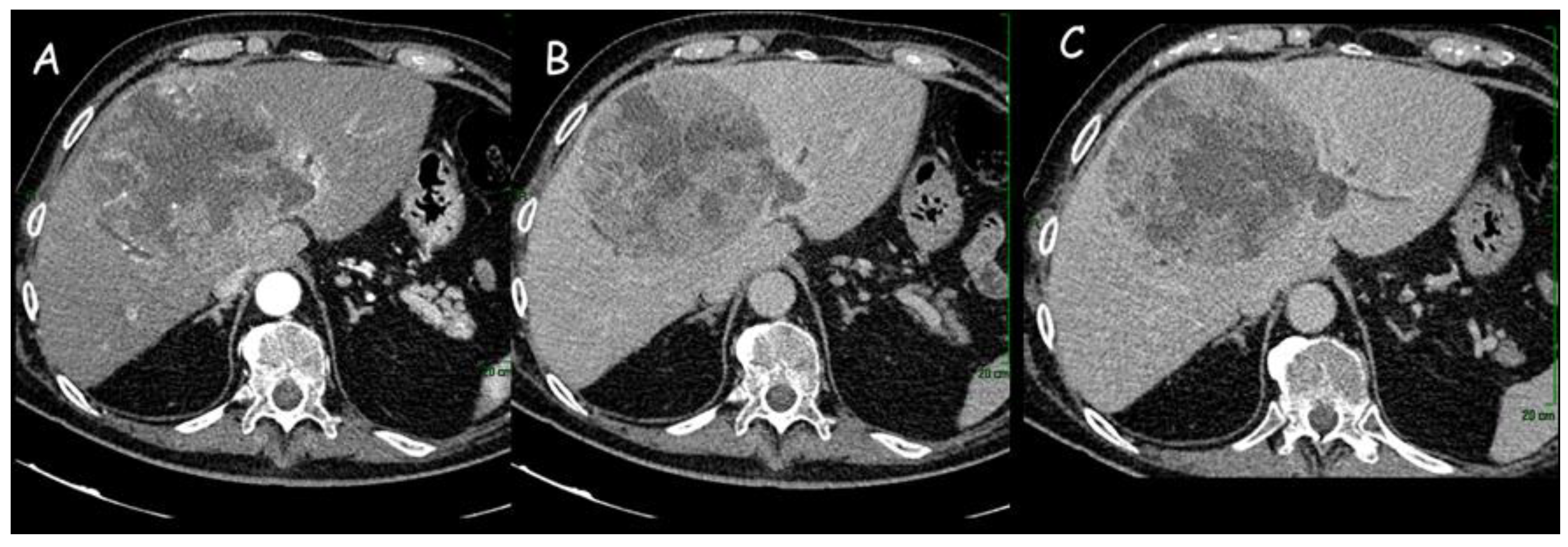 Cancers 15 03393 g001 Cancers 15 03393 g001