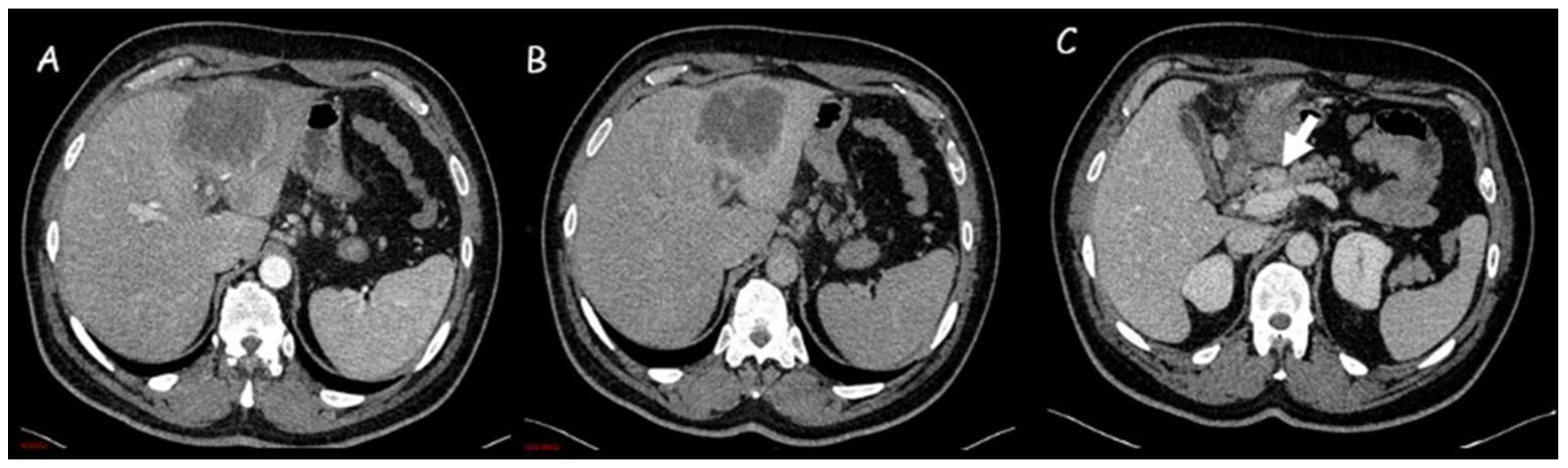 Cancers 15 03393 g002 Cancers 15 03393 g002