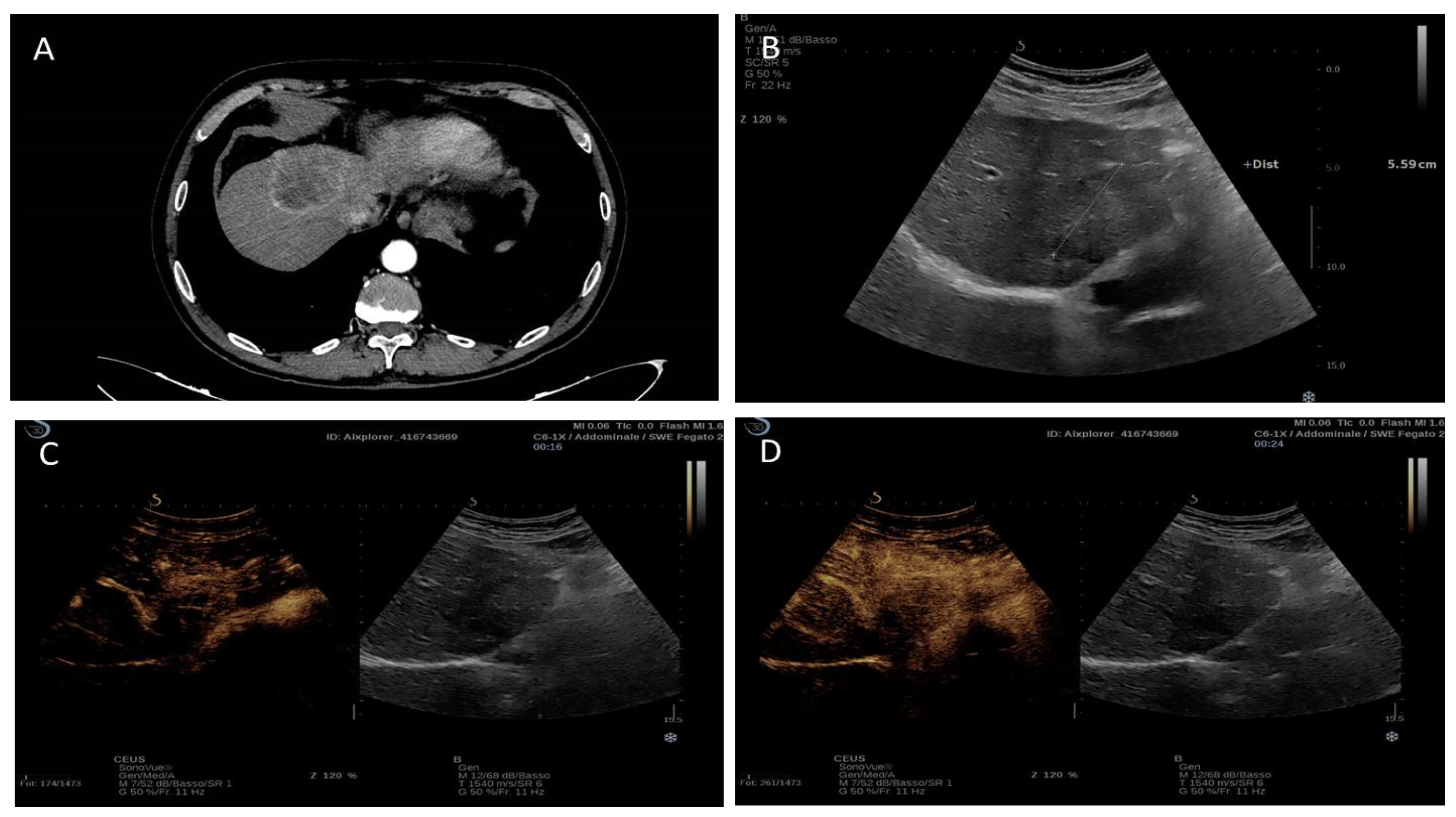 Cancers 15 03393 g005 Cancers 15 03393 g005