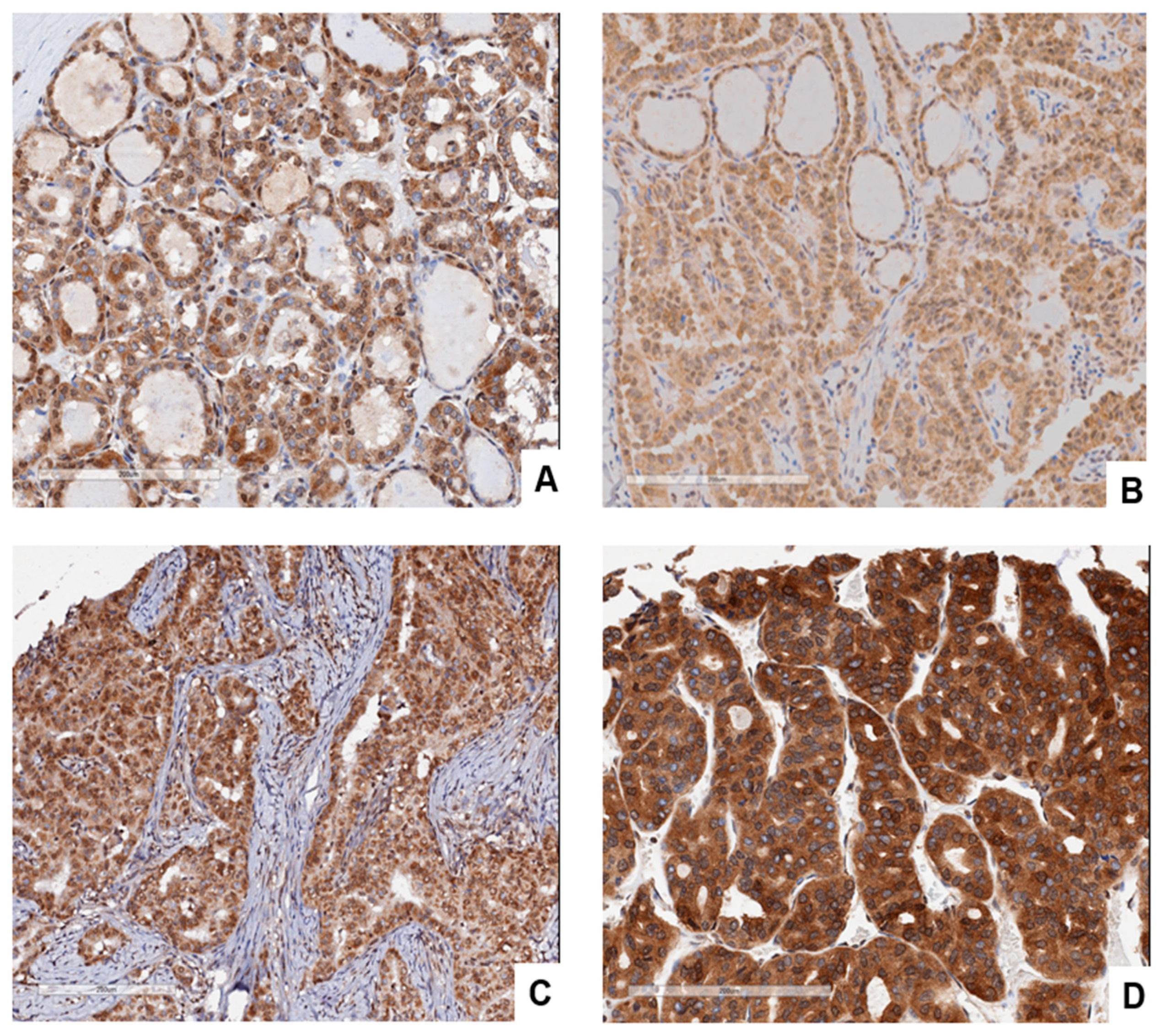 Cancers 15 03404 g004