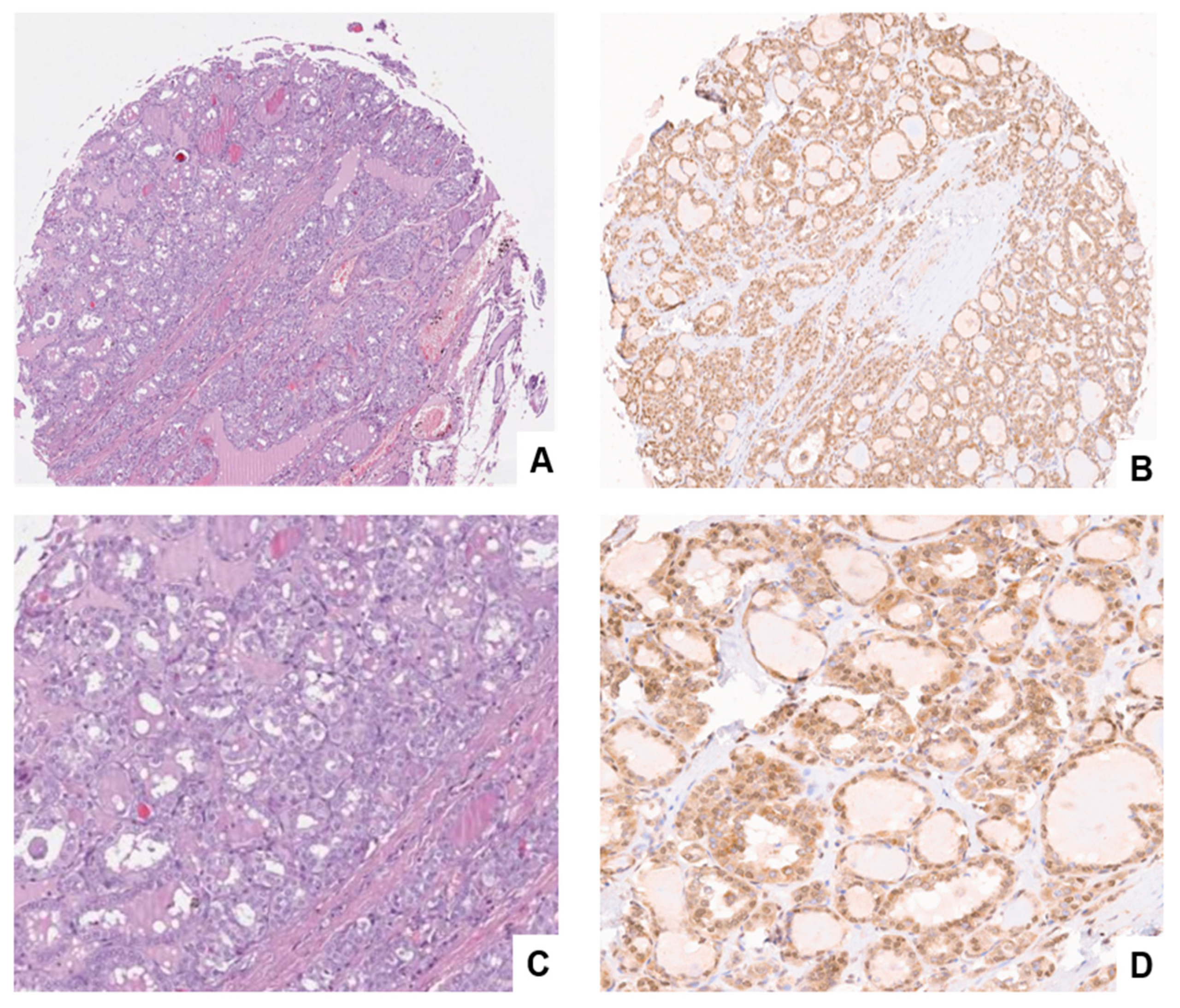 Cancers 15 03404 g005