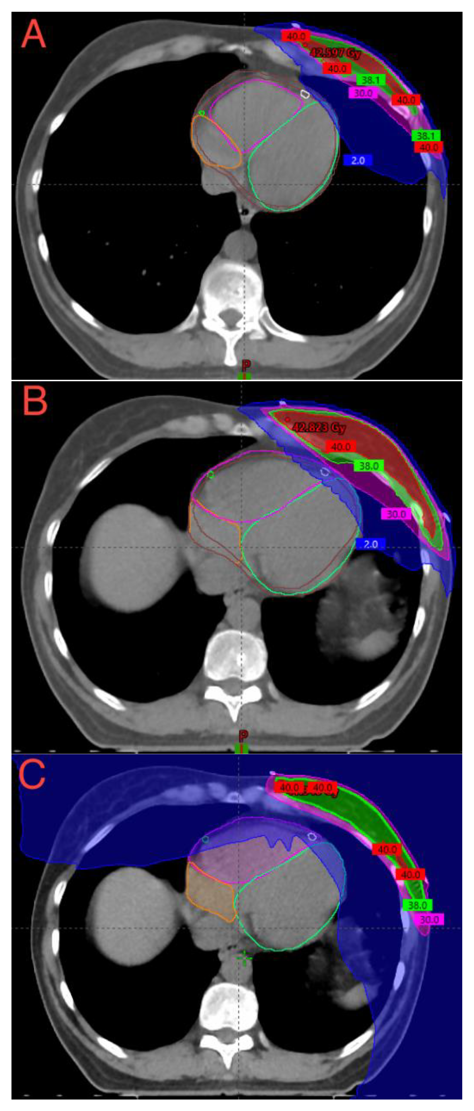 Cancers 15 03406 g002