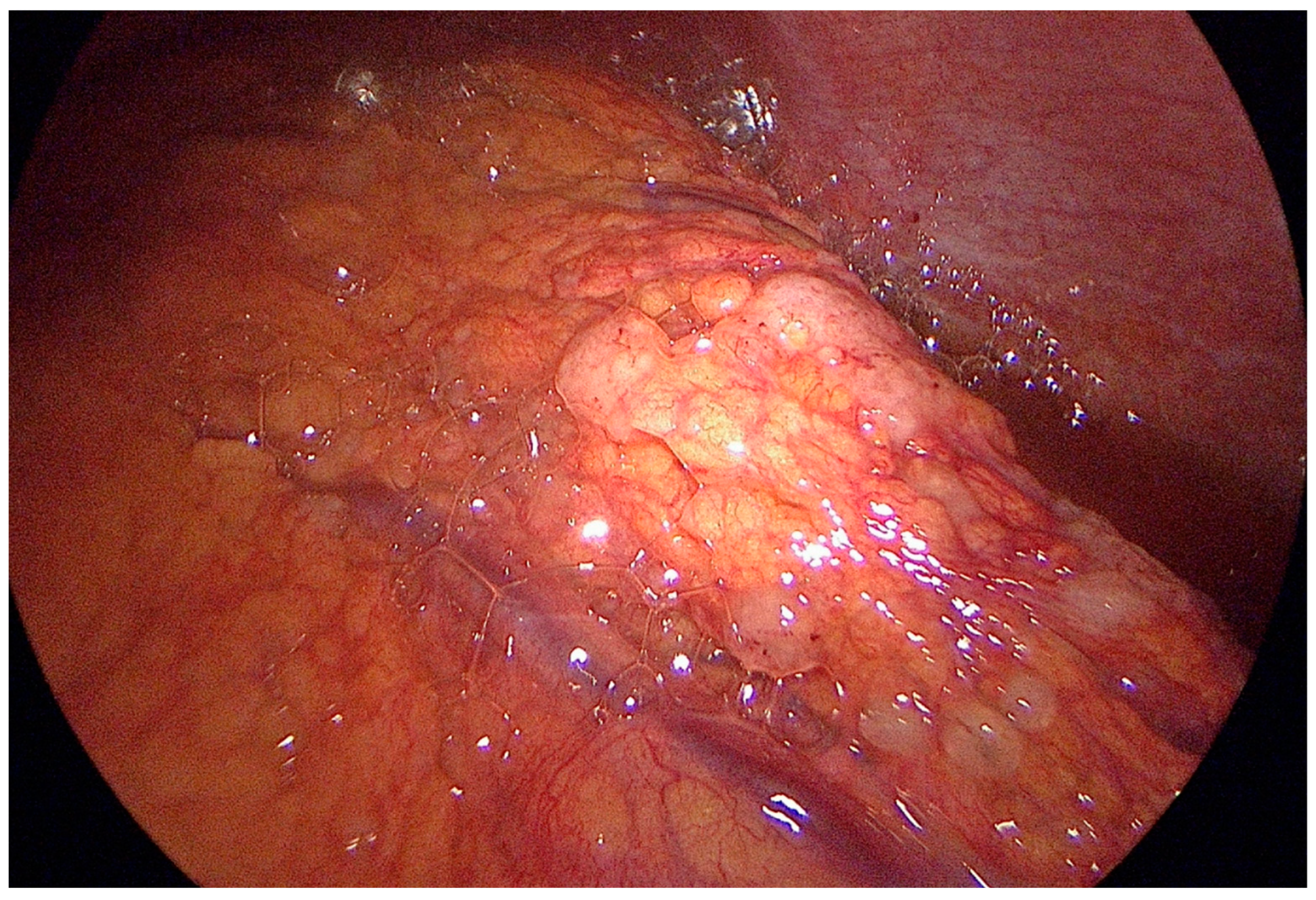 Cancers 15 03425 g002 Cancers 15 03425 g002