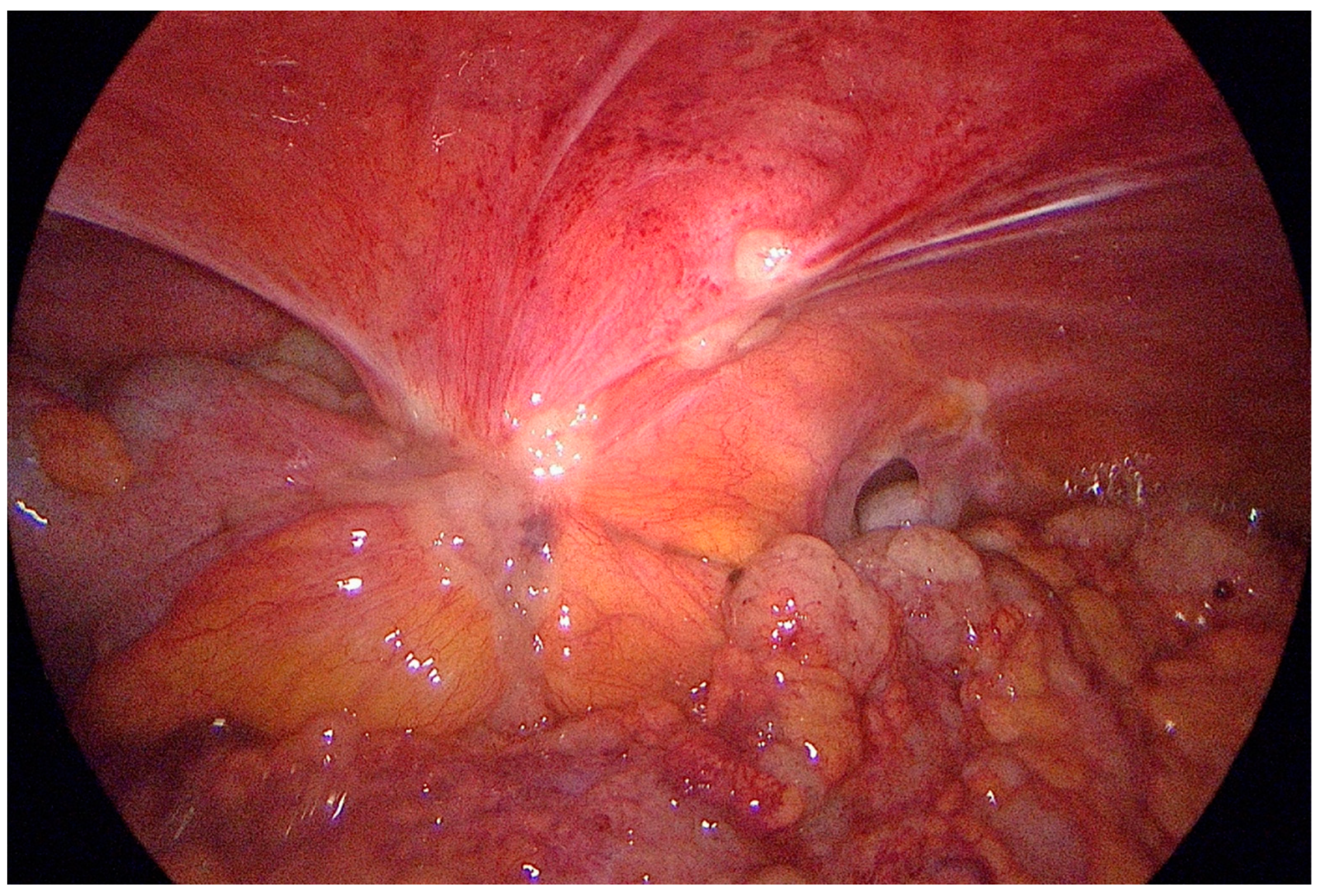 Cancers 15 03425 g003 Cancers 15 03425 g003