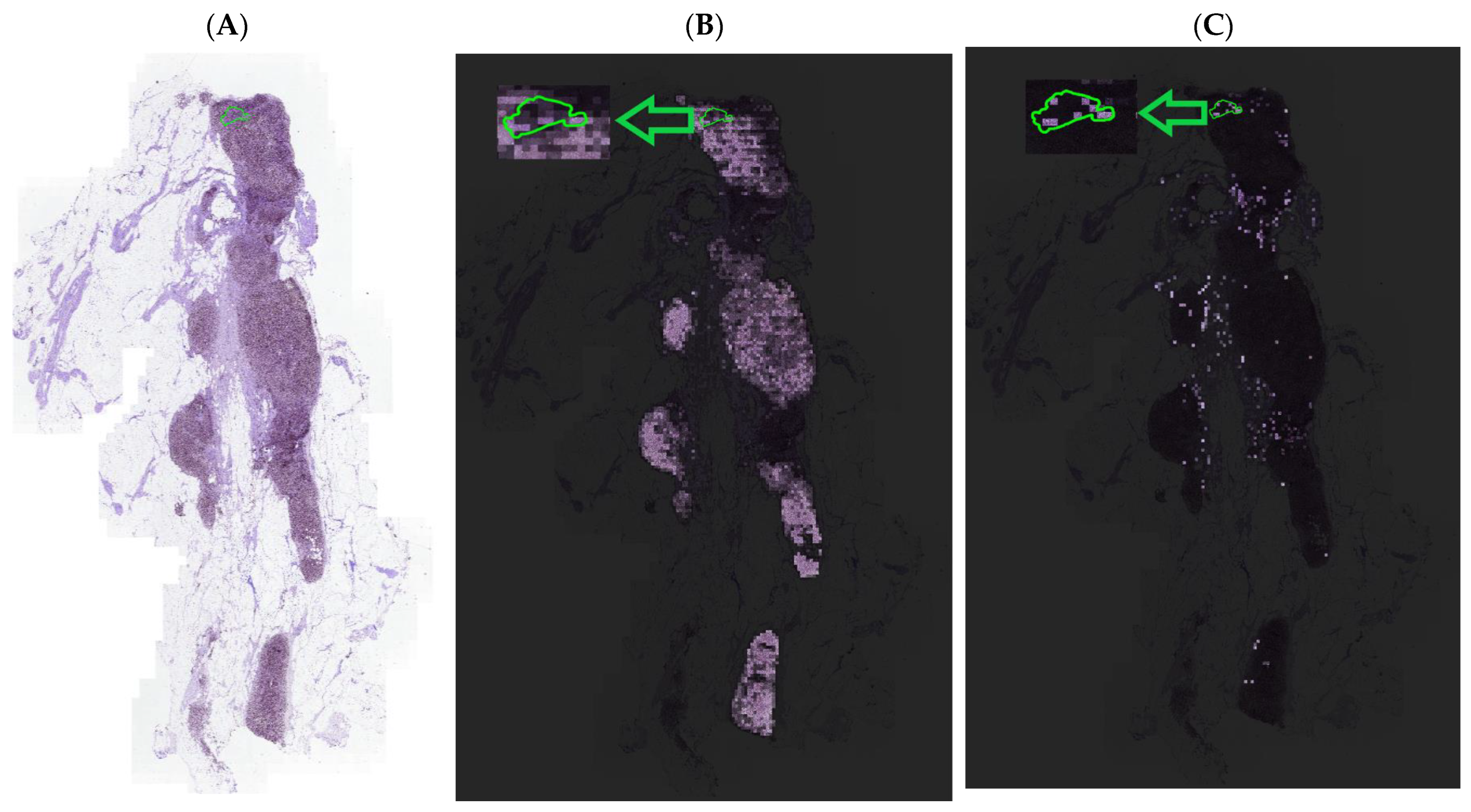 Cancers 15 03428 g006
